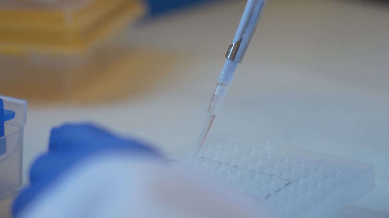 Cáncer de páncreas: logran adelgazar una célula tumoral para que la quimioterapia sea más efectiva