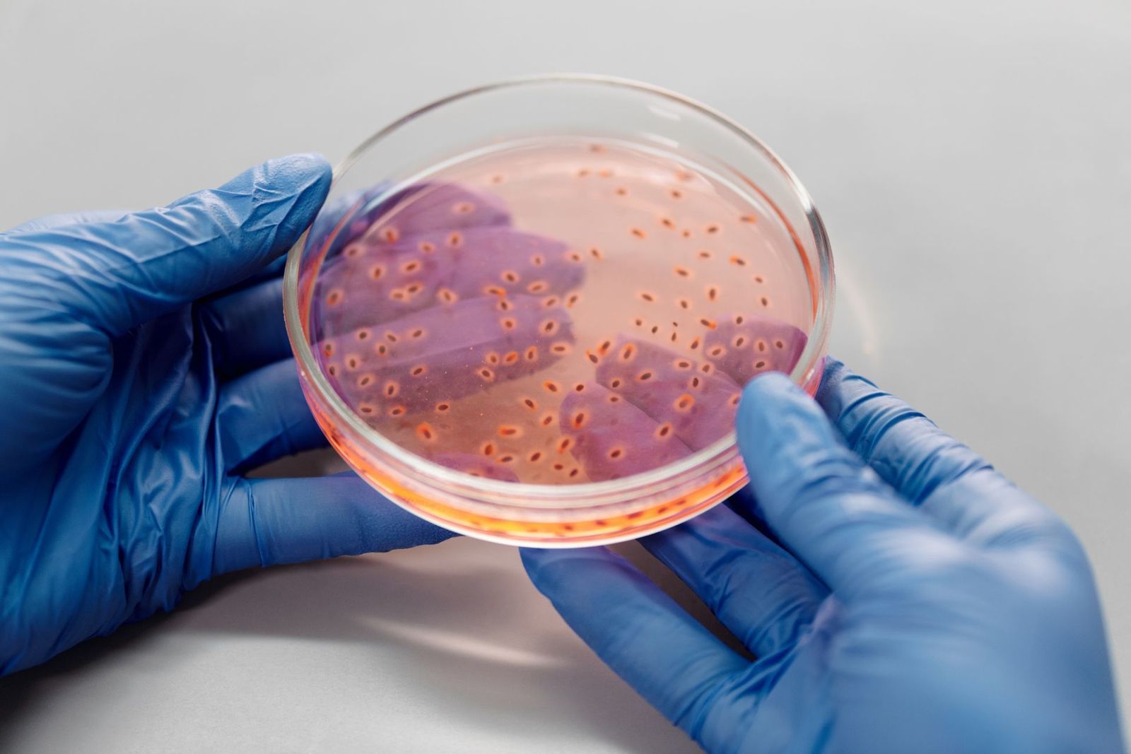Imagen de archivo de manos con guantes sosteniendo una placa de petri con cultivo bacteriano en un entorno de laboratorio