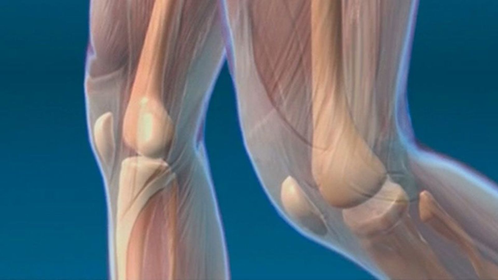 El "fast tracks" acelera la recuperación de los operados de cadera o rodilla
