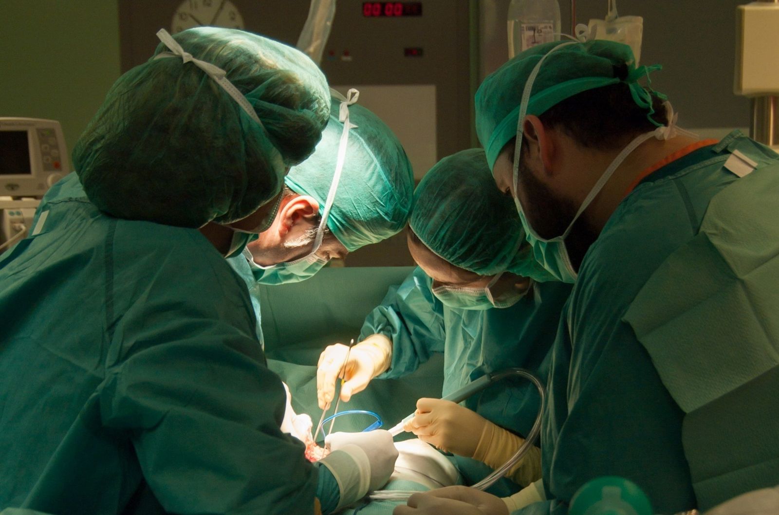 Operación de trasplante de órganos