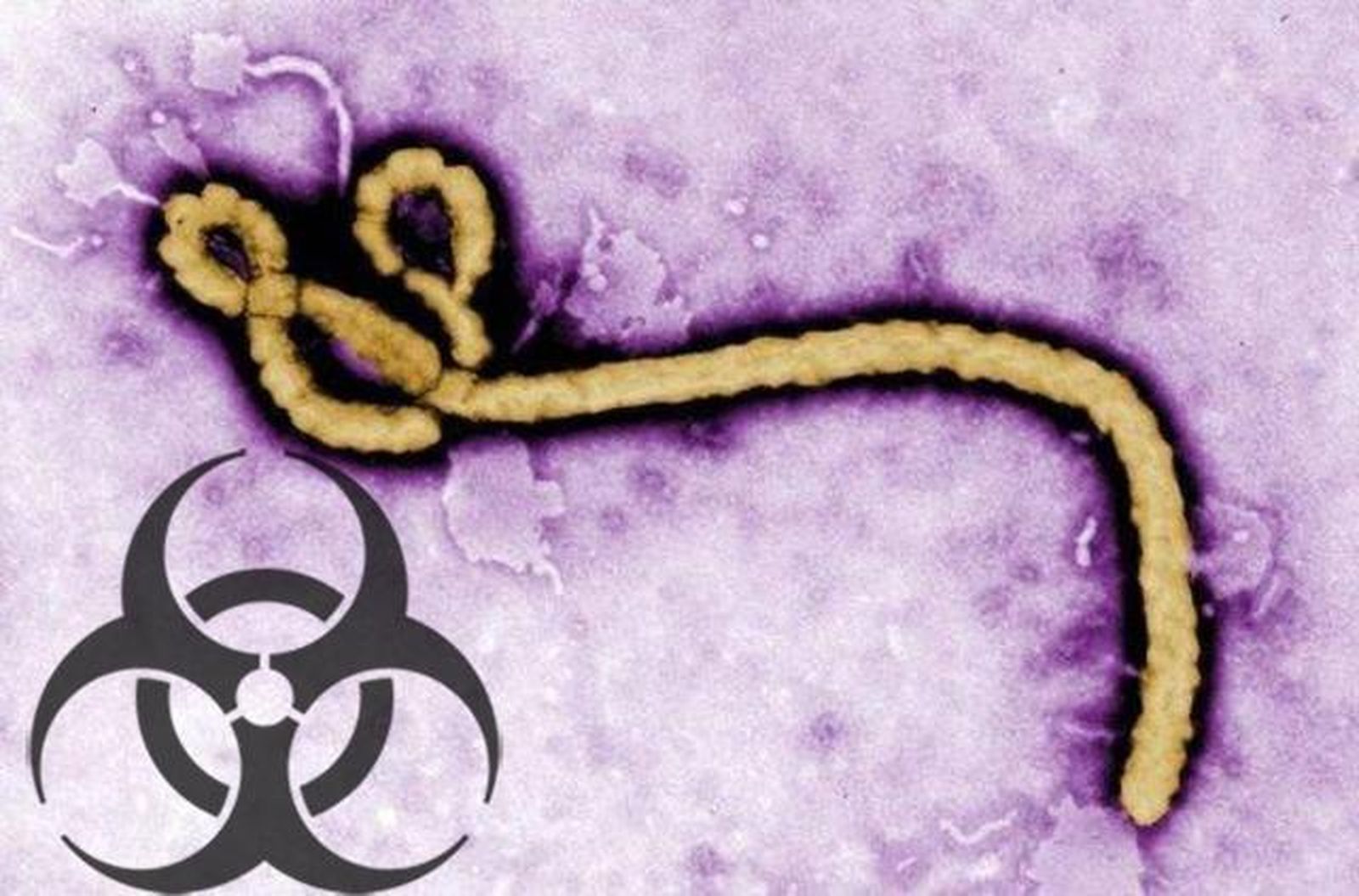 ebola_3245