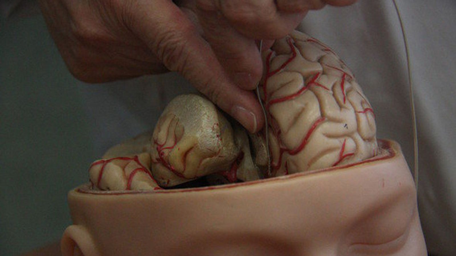 cerebro_3234
