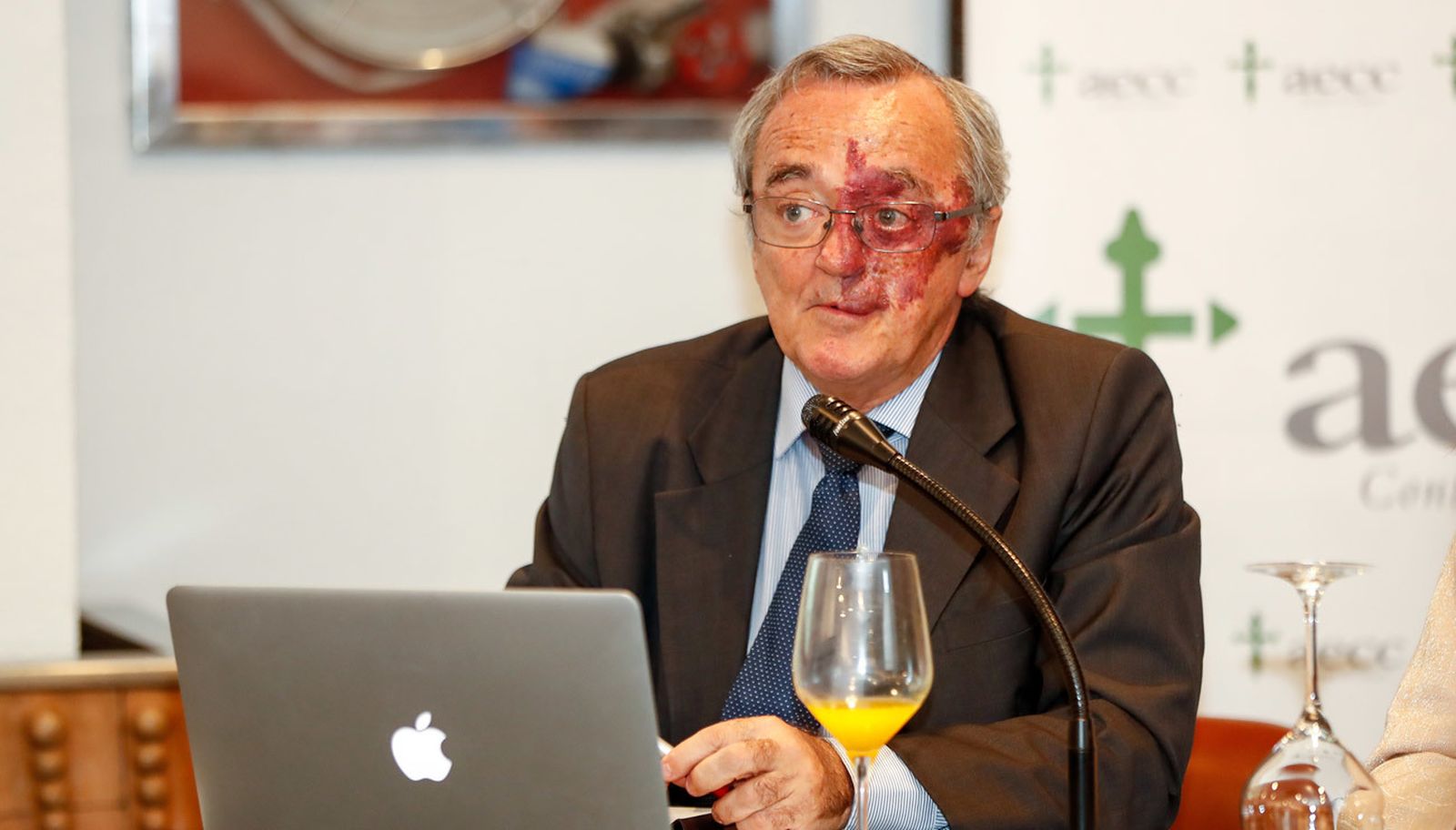 Mariano Barbacid, durante la presentación de los prometedores resultados de una investigación contra el cáncer de páncreas