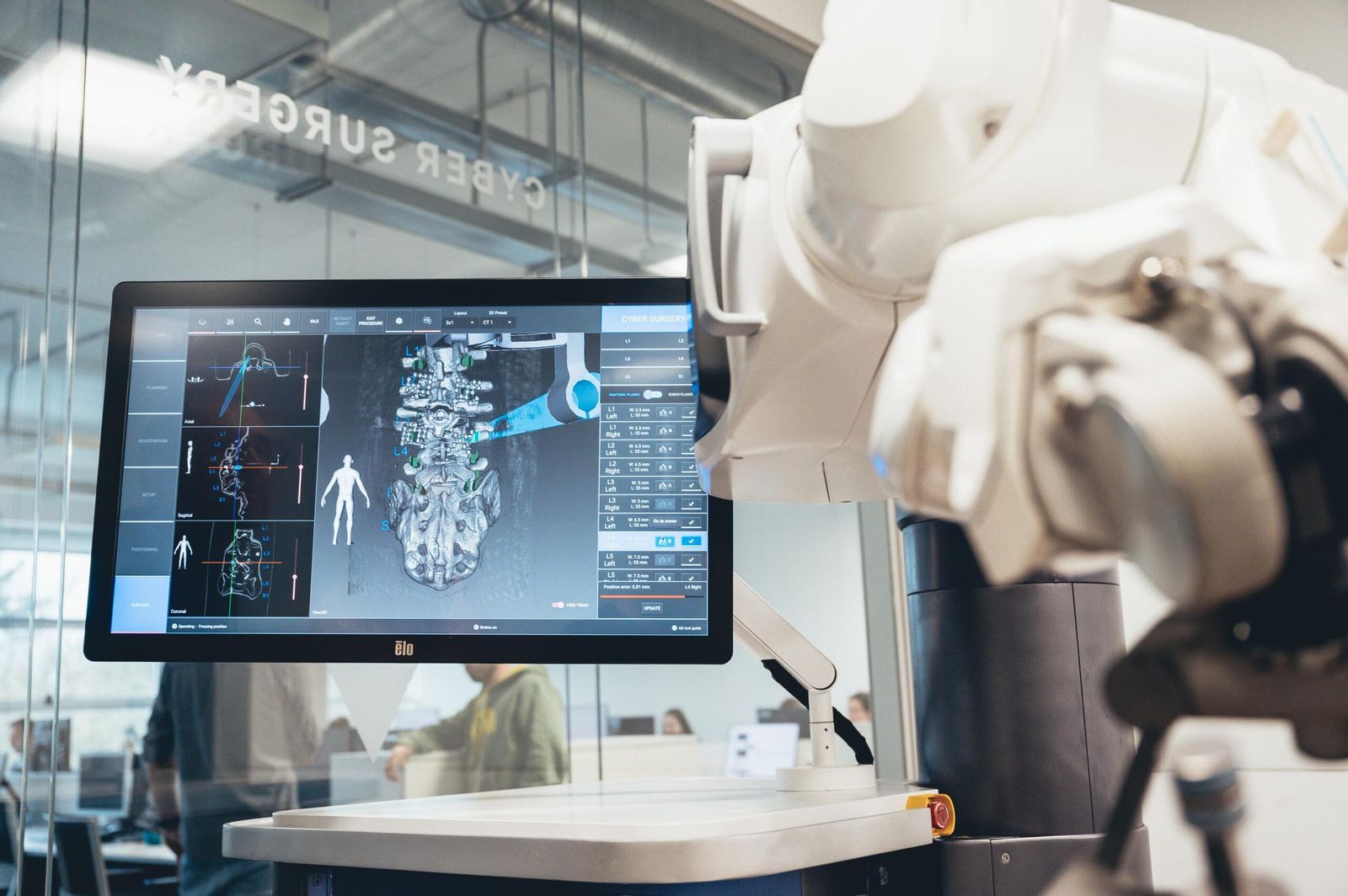 Presentan el primer robot quirúrgico del mundo con ‘tracking system’ mecánico para operaciones de columna con tecnología 100% española