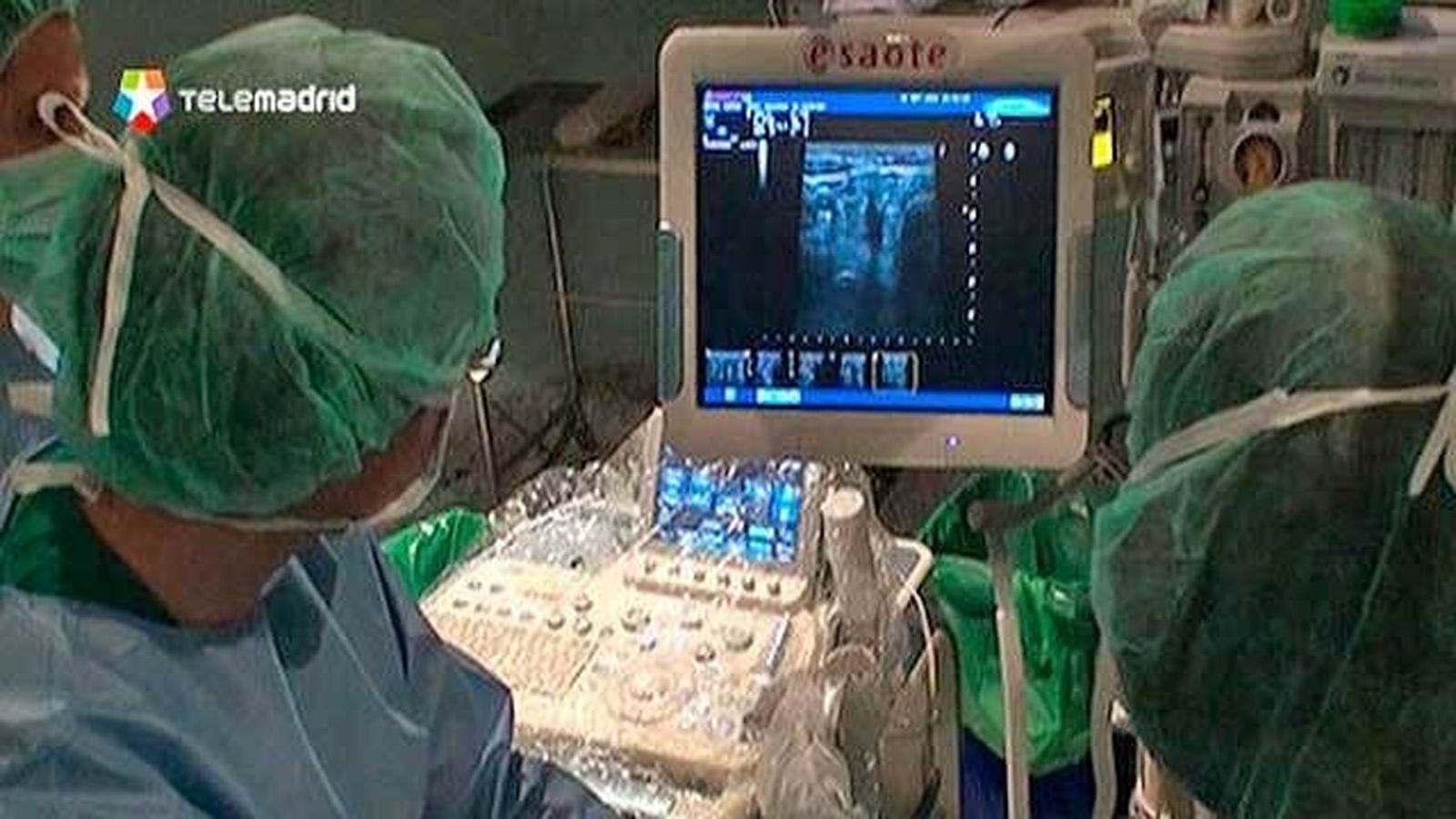 El Gregorio Marañón pionero en la ablación por radiofrecuencia para nódulos tiroideos