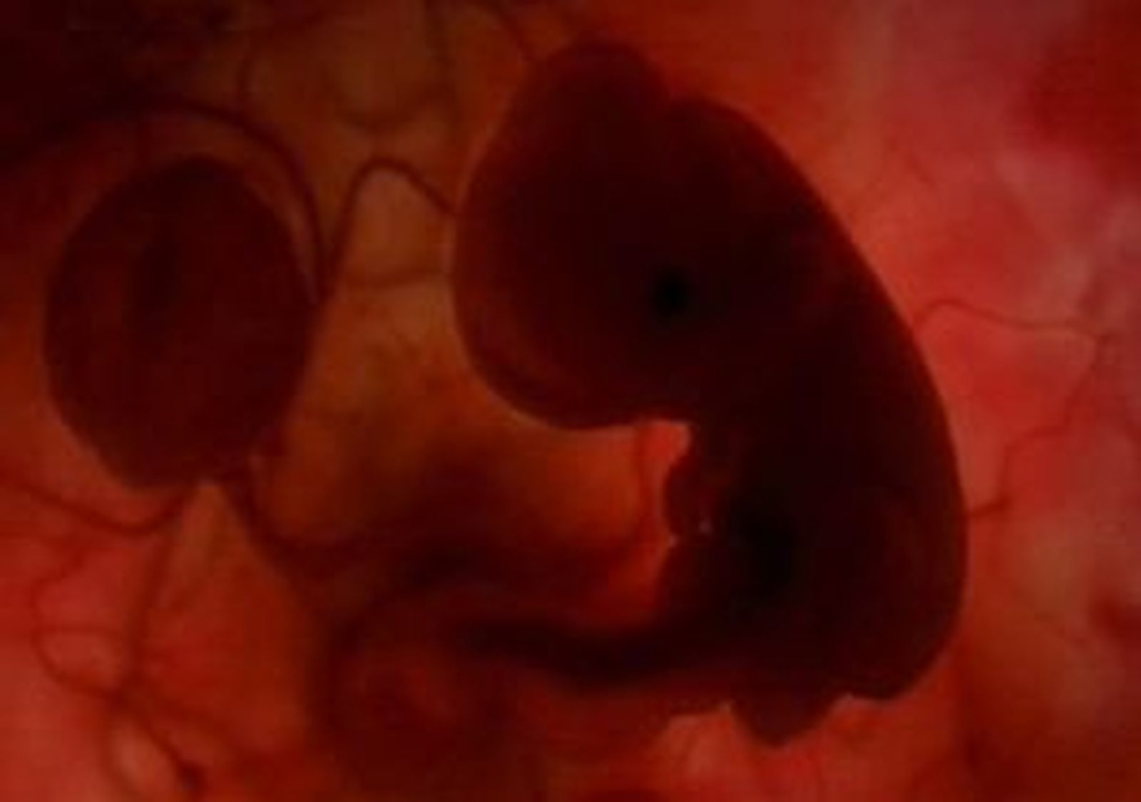 Las asociaciones provida cuestionan que haya disminuído el aborto