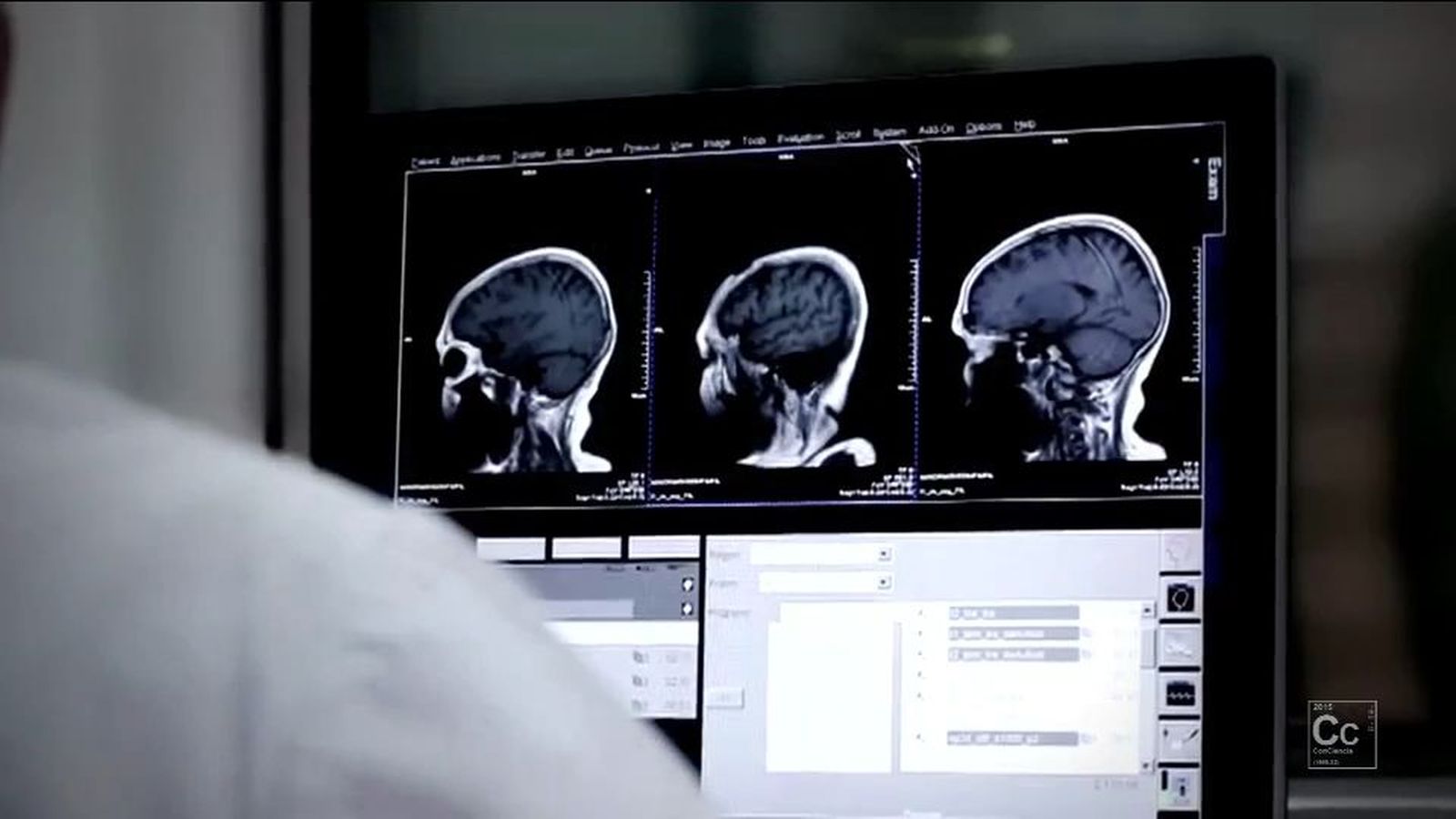 Investigadoras del CSIC descubren un nuevo mecanismo para activar las células madre del cerebro adulto