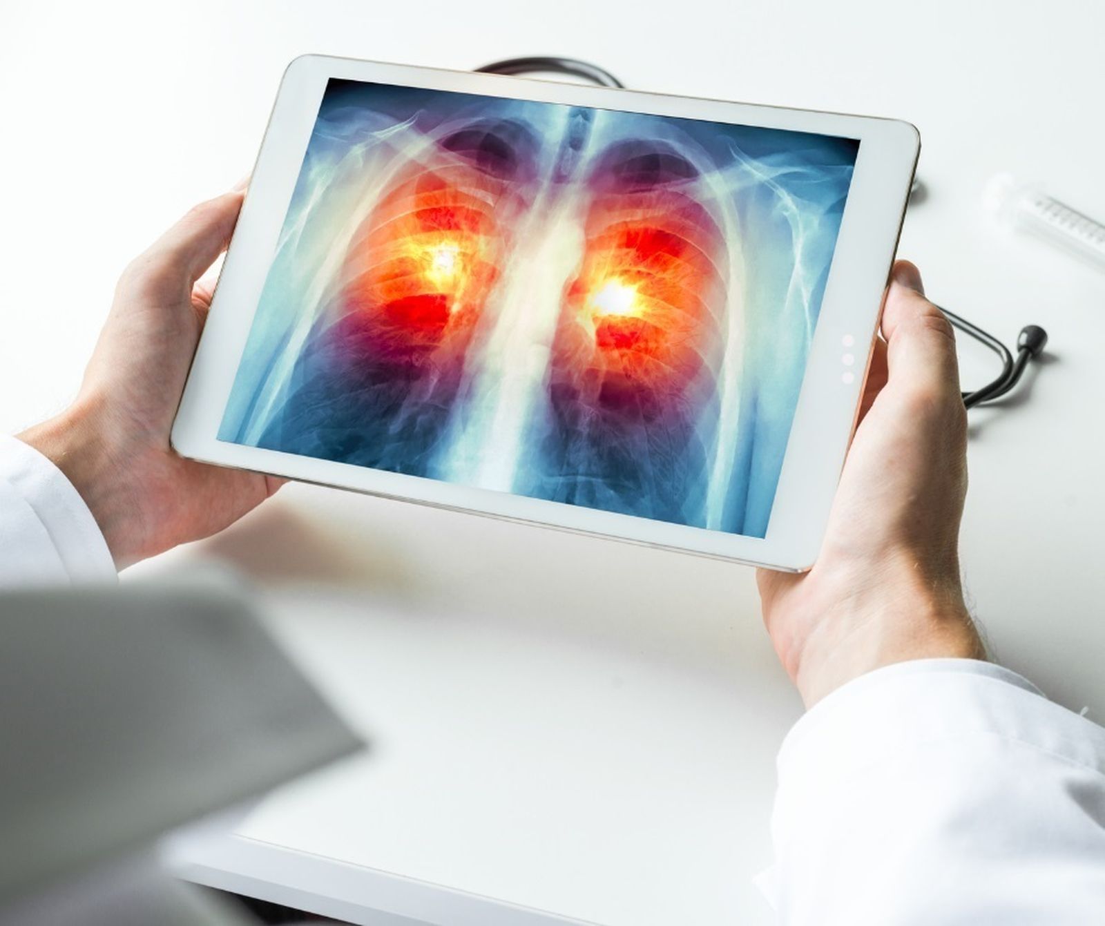 Investigación contra el cáncer de pulmón