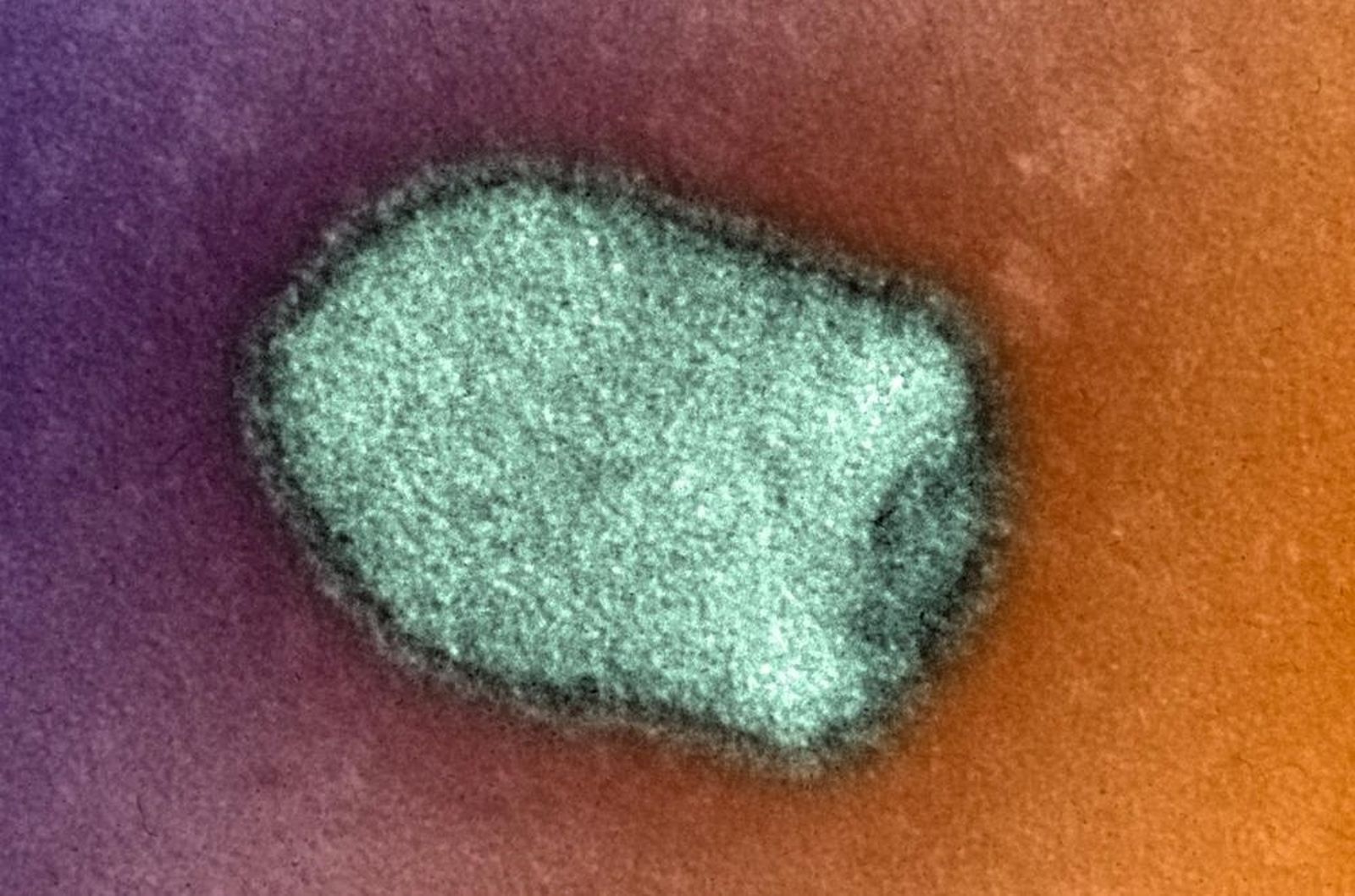 Virus de la rabia