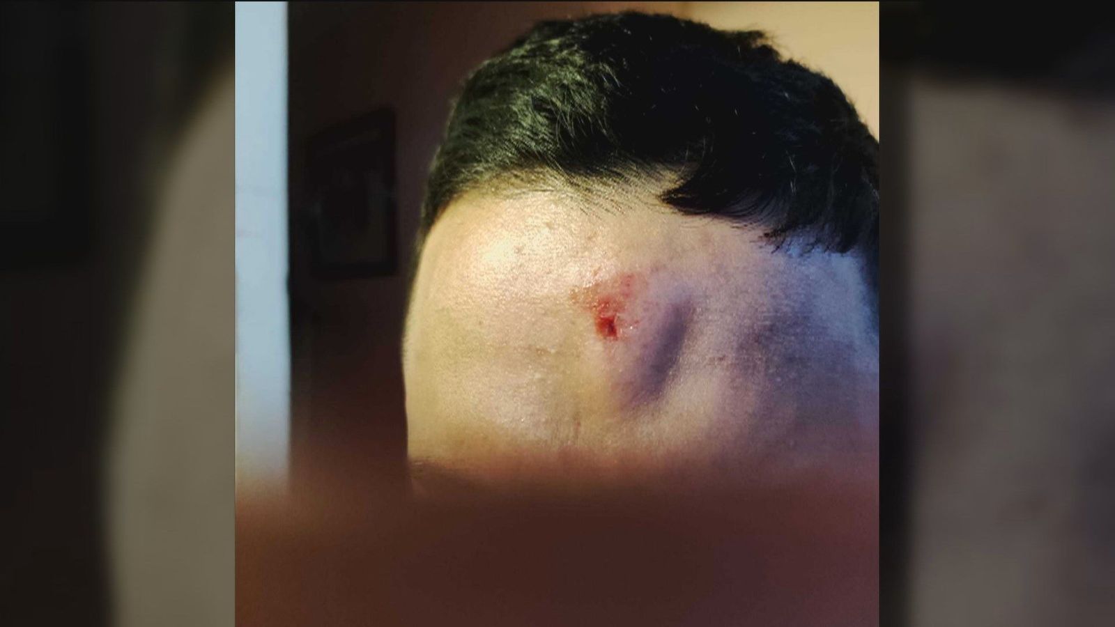 Agreden brutalmente a un joven de 22 años en Batán para robarle el móvil