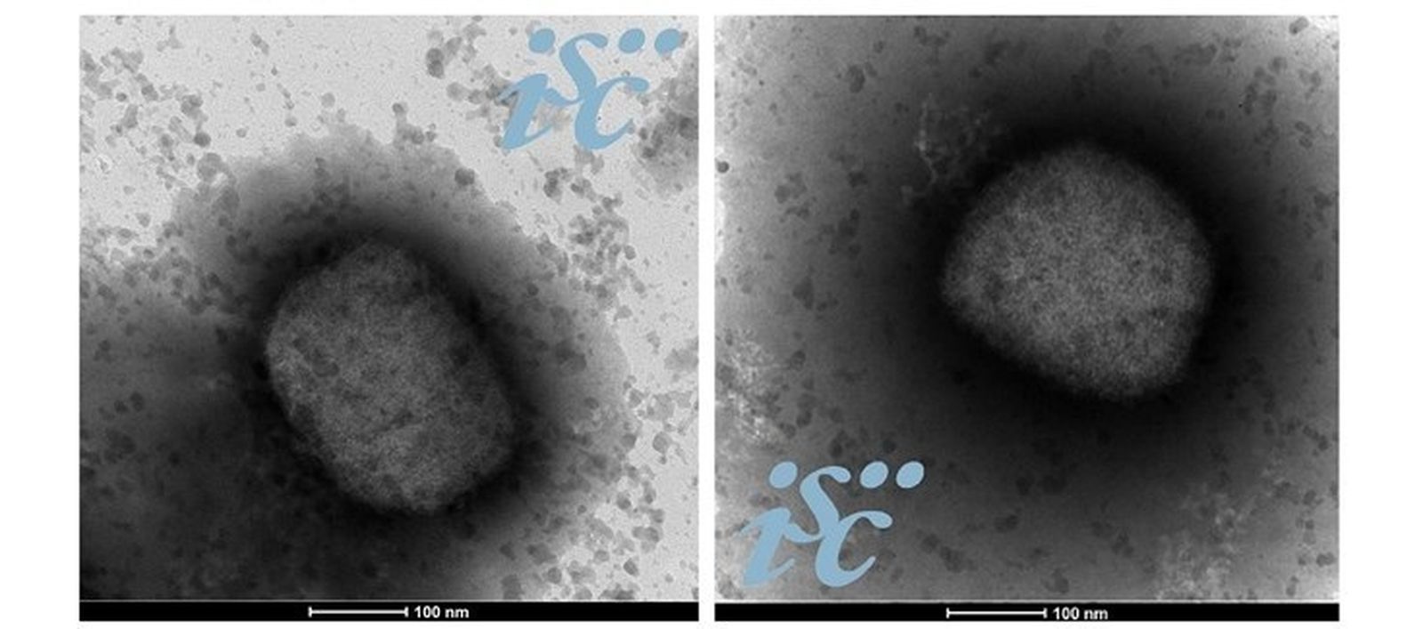 Imágenes del virus de la viruela del mono