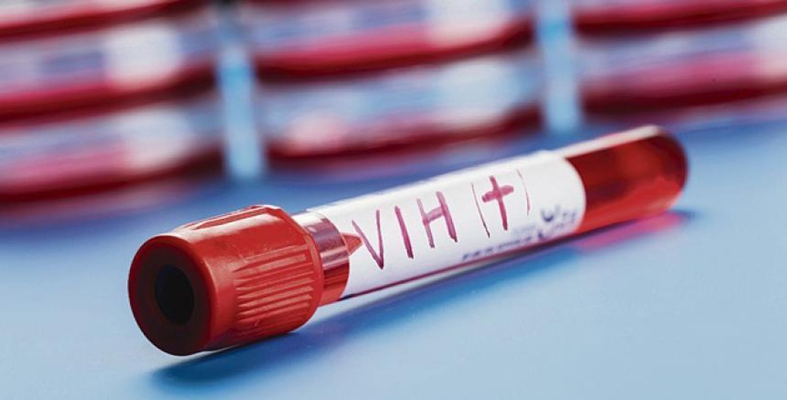 Para un 64%  de los españoles encuestados, el VIH es un problema de salud pública.
