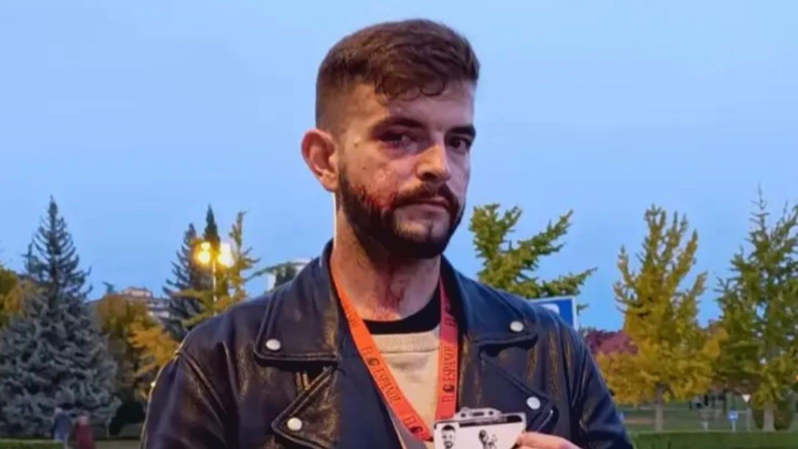 Brutal agresión de abertzales a un periodista de El Español durante unas protestas en Pamplona