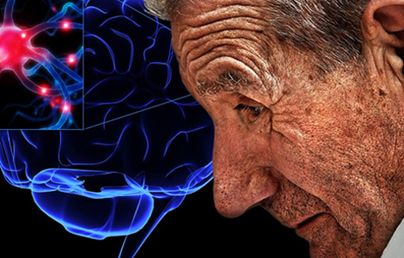 parkinson470_