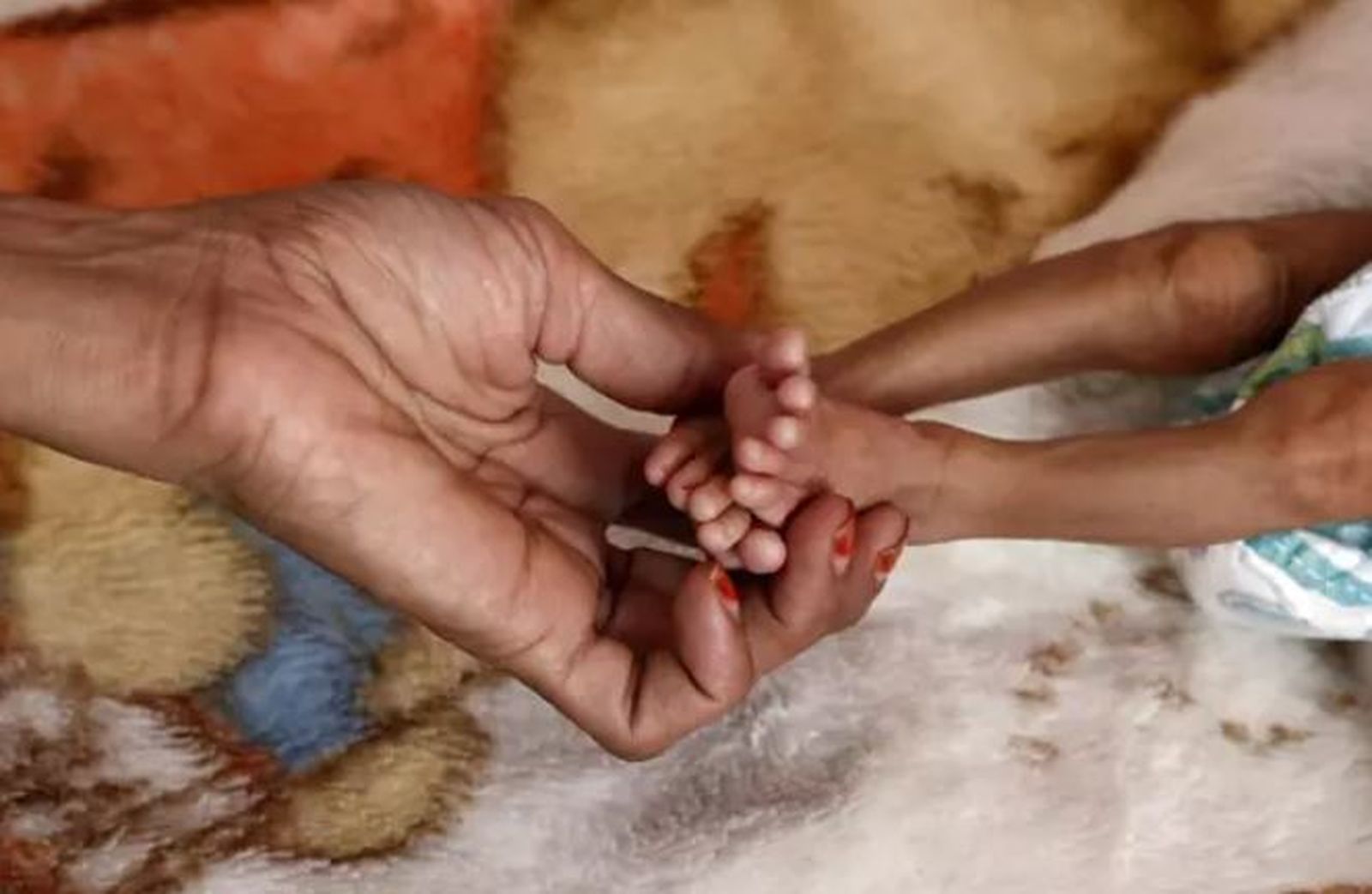 Más de 19 millones de personas están al borde de una hambruna "devastadora", un 50 por ciento más que en 2019