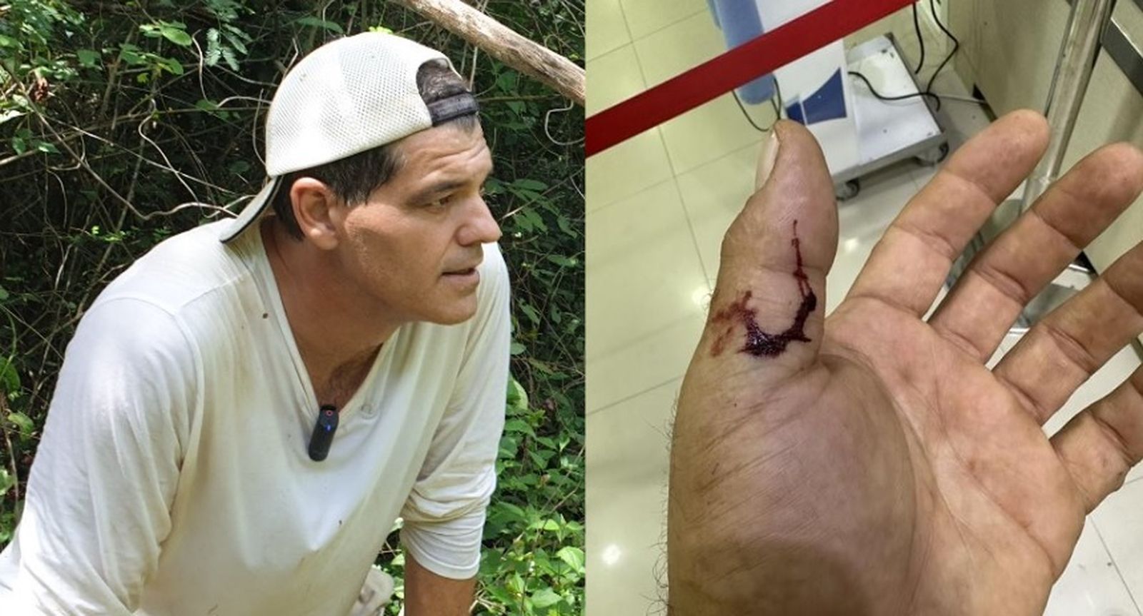 Frank Cuesta comparte cómo ha quedado su mano tras el incidente