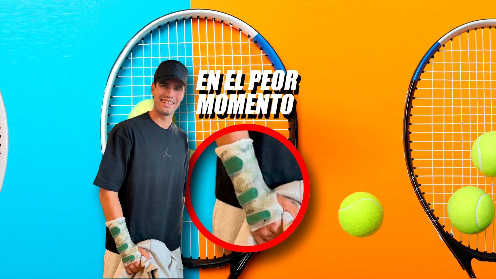 Alcaraz duda para Roland Garros