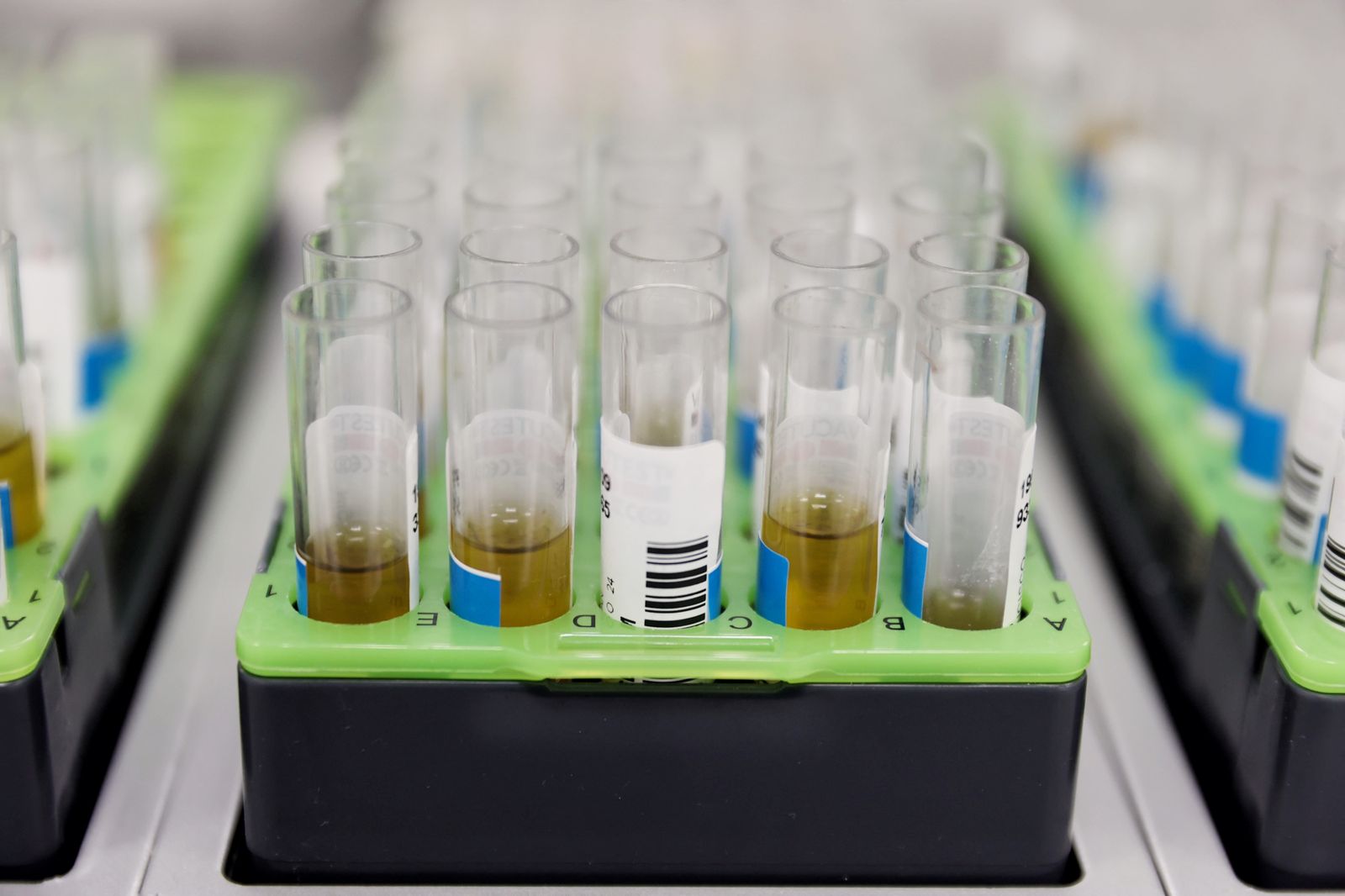 Probetas de pruebas PCR en el Laboratorio de Microbiología del Hospital público Gregorio