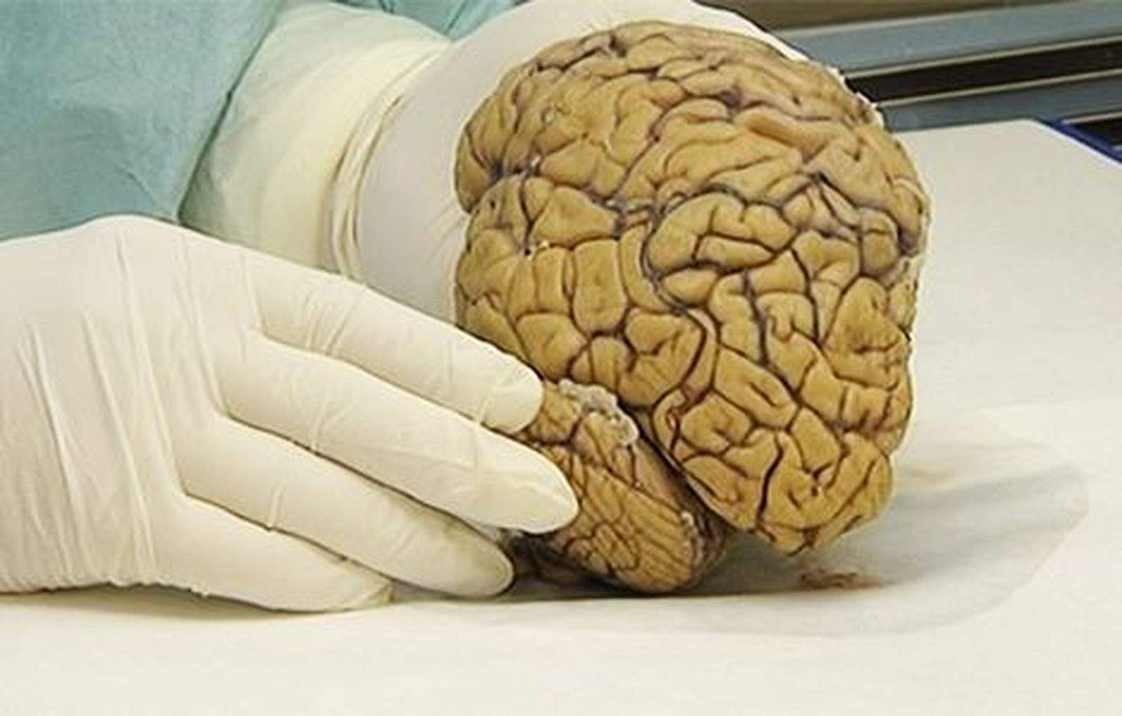 La Fundación CIEN explica a la Reina sus avances para detectar el alzhéimer
