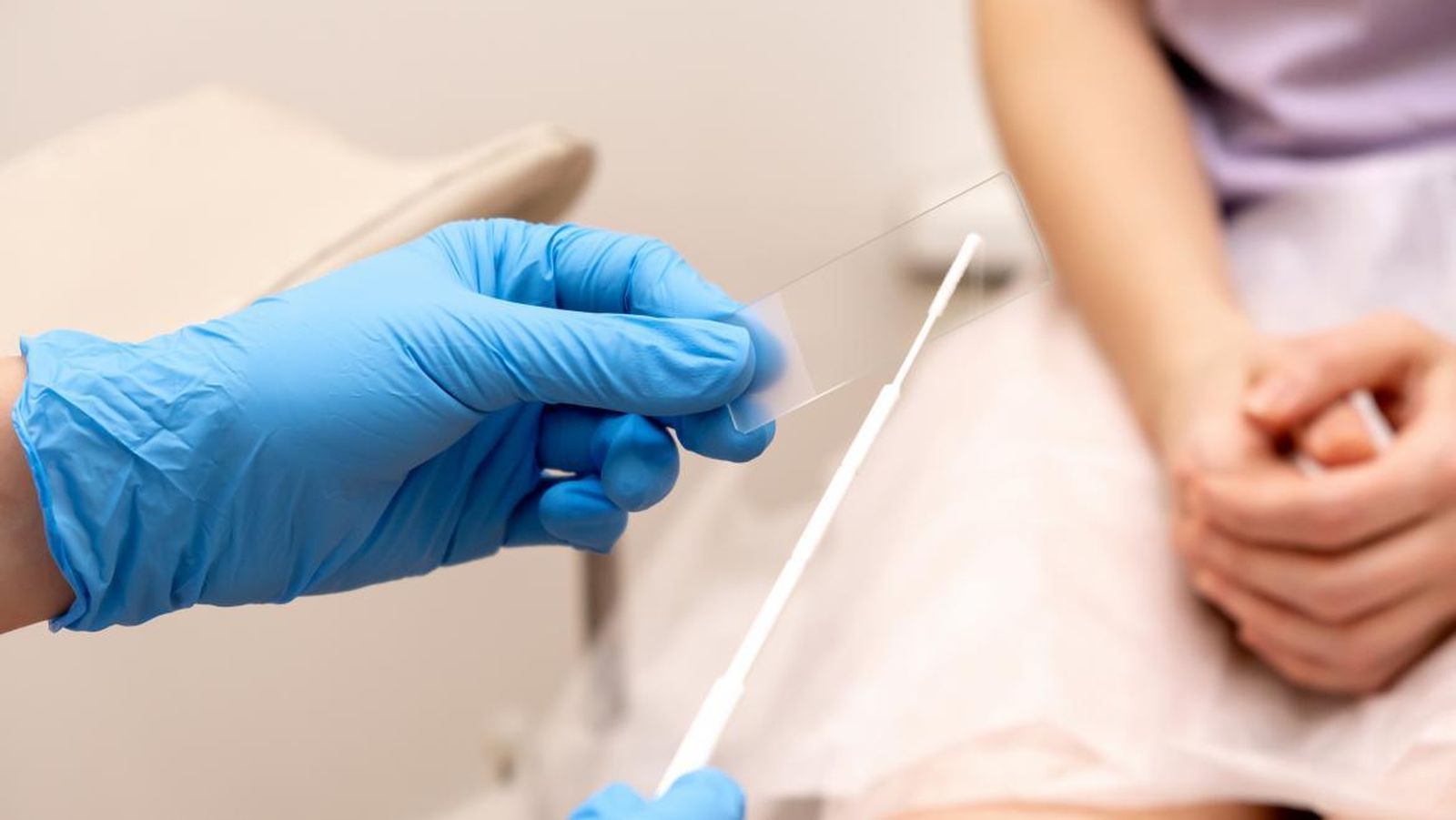 Prueba de cáncer de cérvix