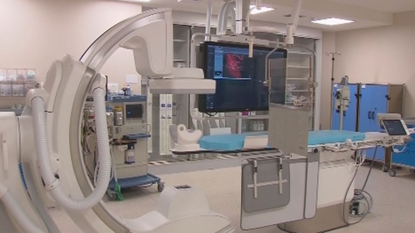 Nueva tecnología de vanguardia en el Hospital Gregorio Marañón para tratar el ictus