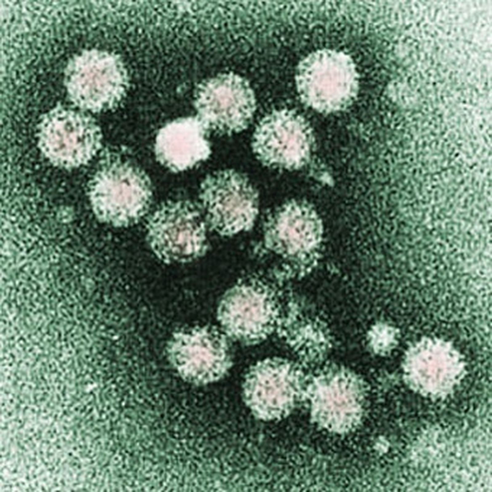 Virus de la hepatitis