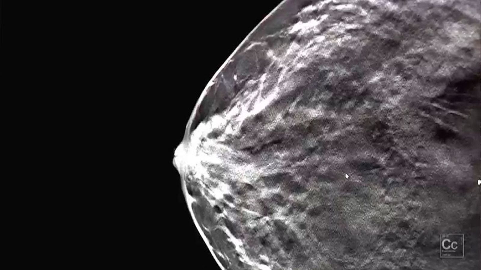 ConCiencia: Derrotando al cáncer