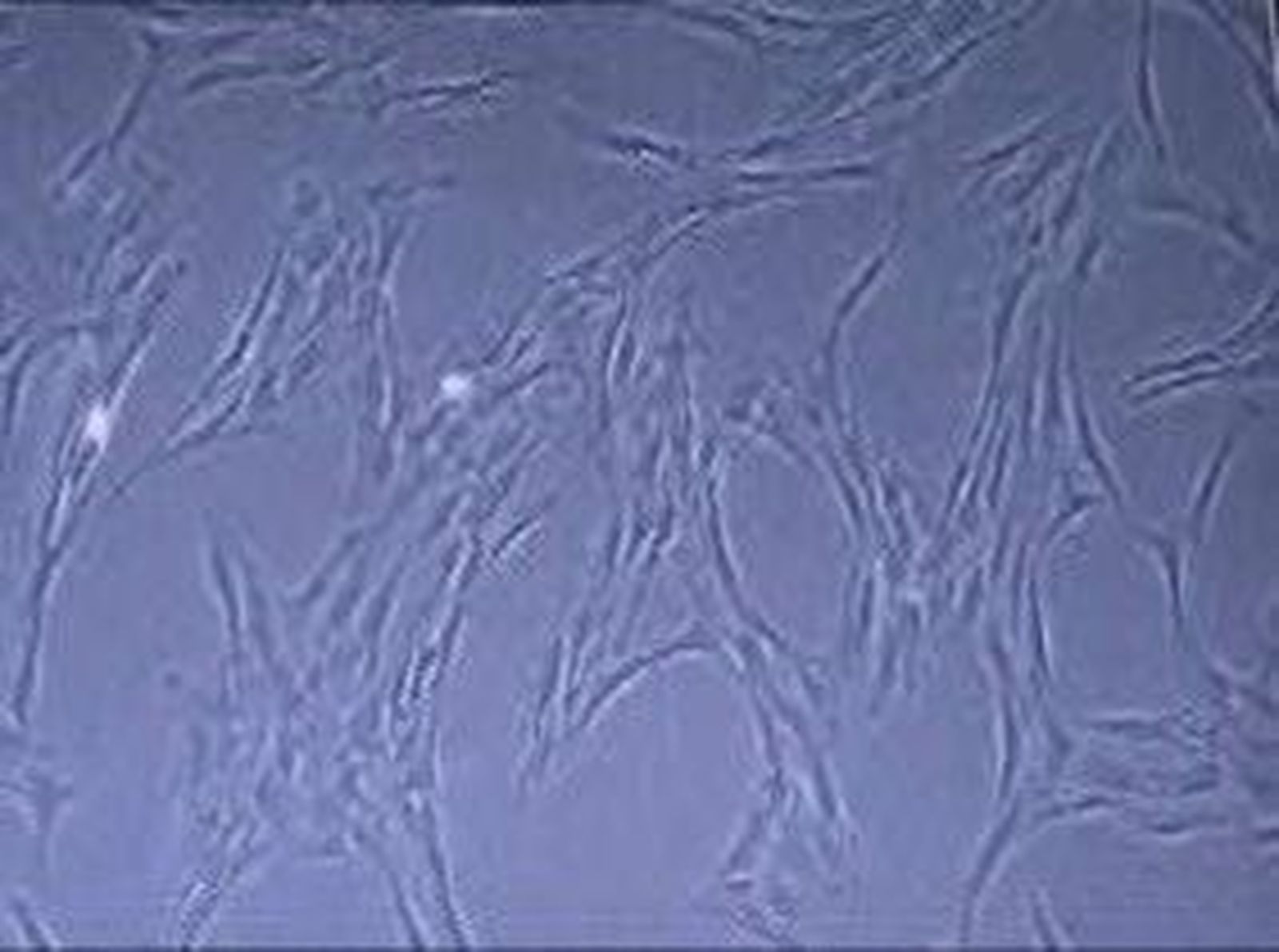 cancernino_2010727V0.wmv