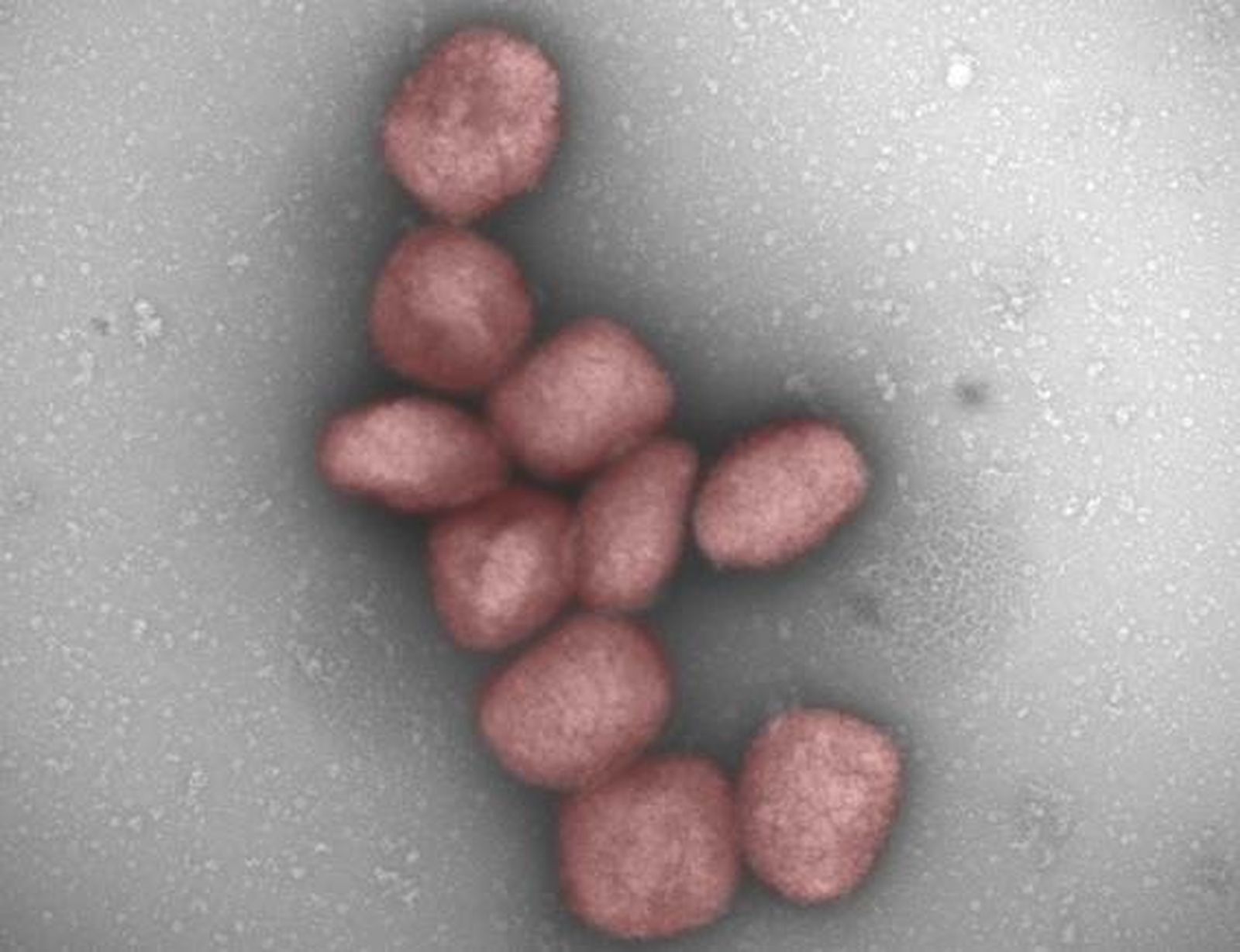 Partículas del virus de la viruela del mono teñidas de rojo