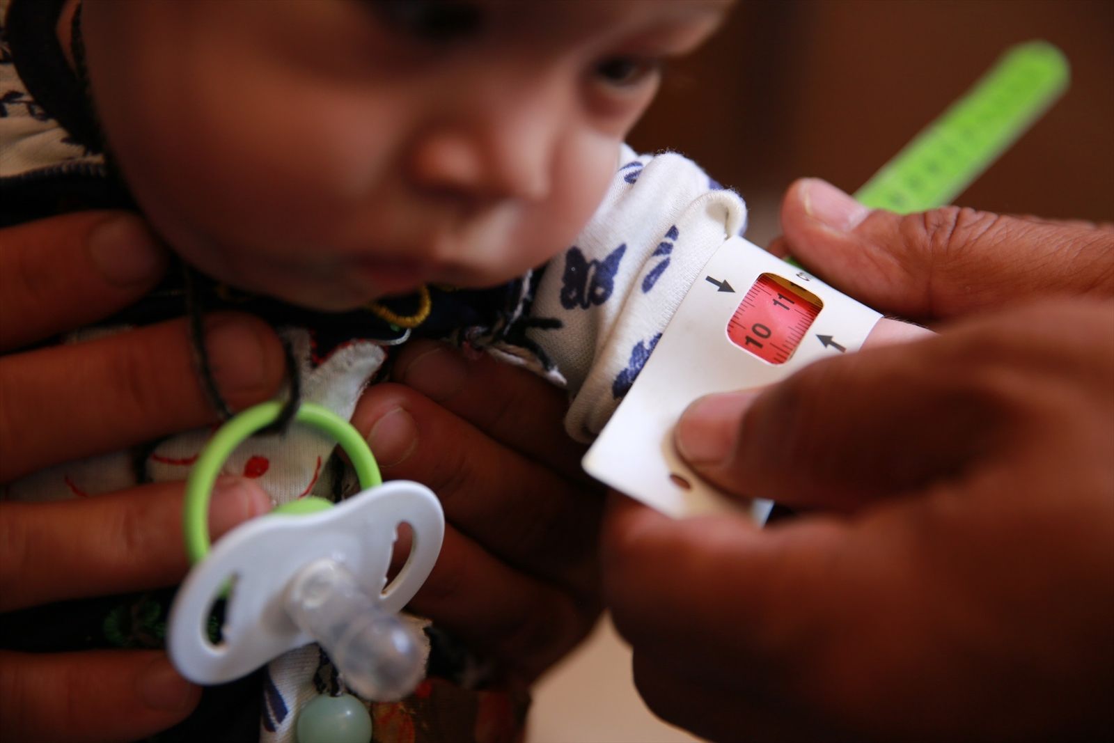 Medición del nivel de desnutrición de una niña en Afganistán