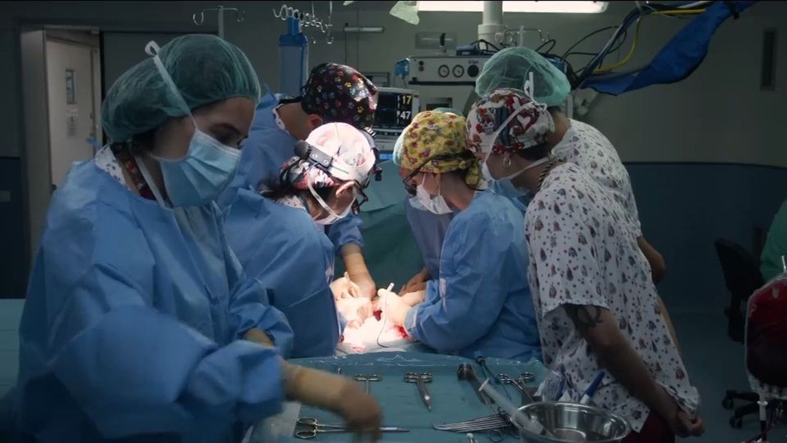 El Hospital La Paz realiza el primer trasplante de intestino del mundo en asistolia
