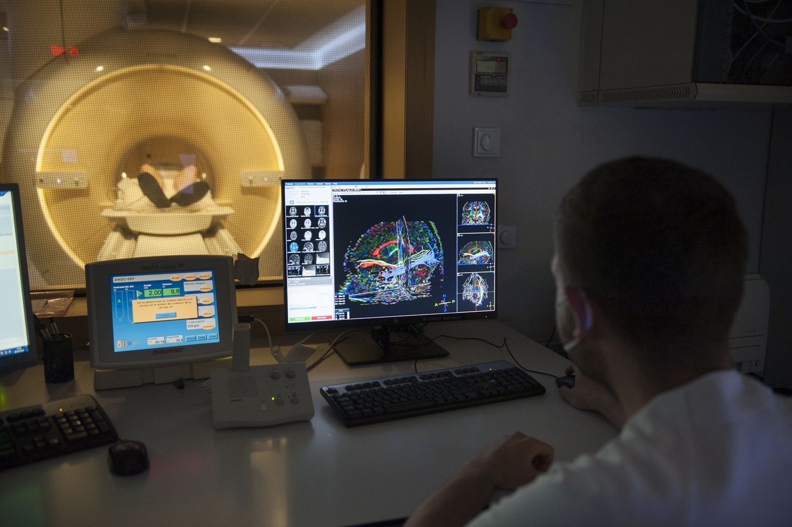 Resonancia magnética para localización de tumor cerebral