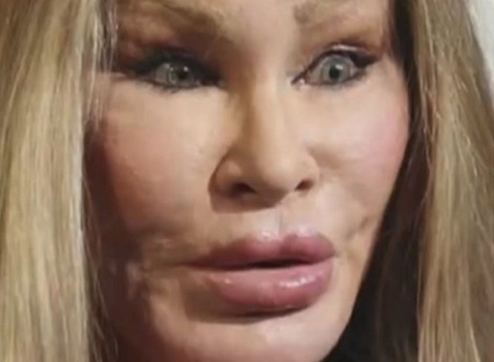 Cuando una operación de estética te puede costar la vida