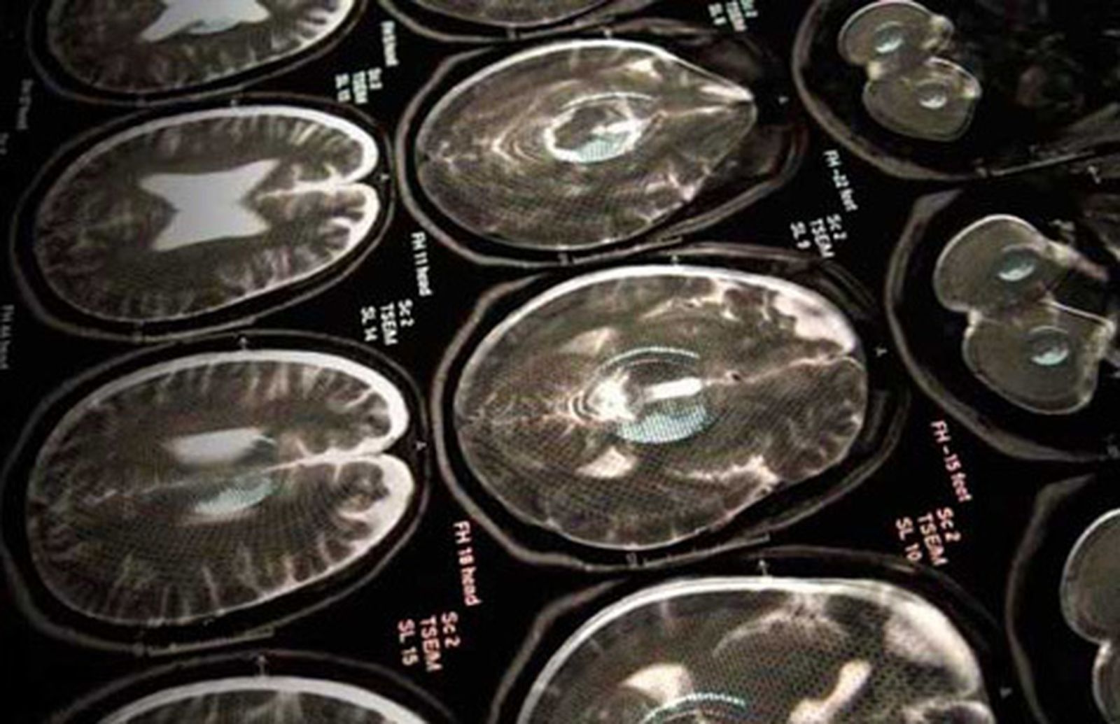 neurospaces300
