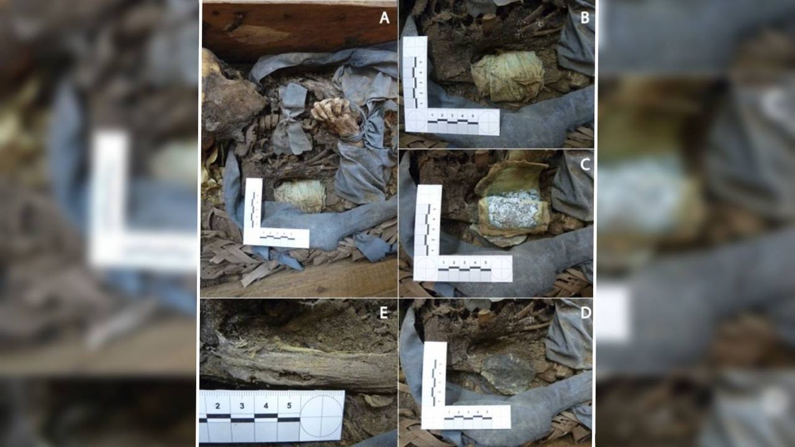 Investigación de la UCM sobre cómo se trataba la enfermedad y el ritual funerario en el siglo XIX en Madrid