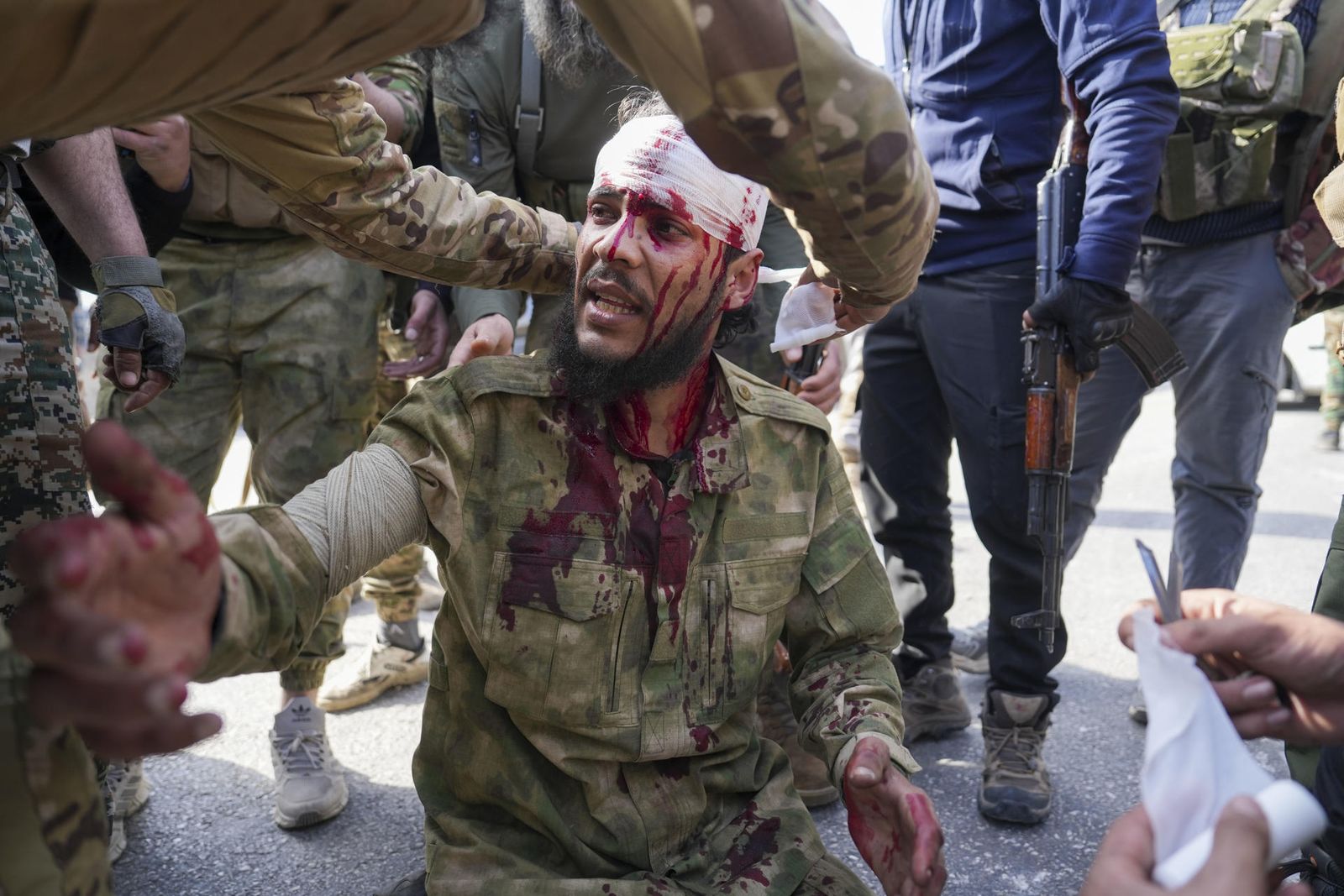 Soldado sirio herido