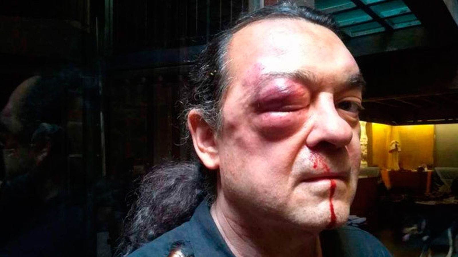 Brutal agresión a Fernando Barredo