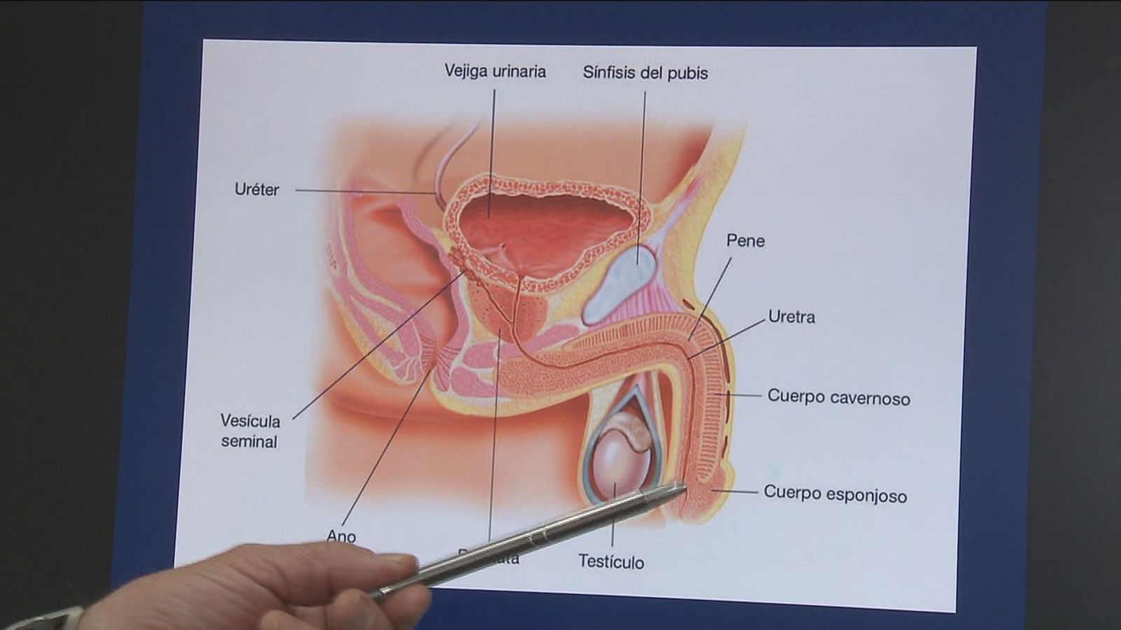 Aumentar el grosor del pene está de moda en Madrid