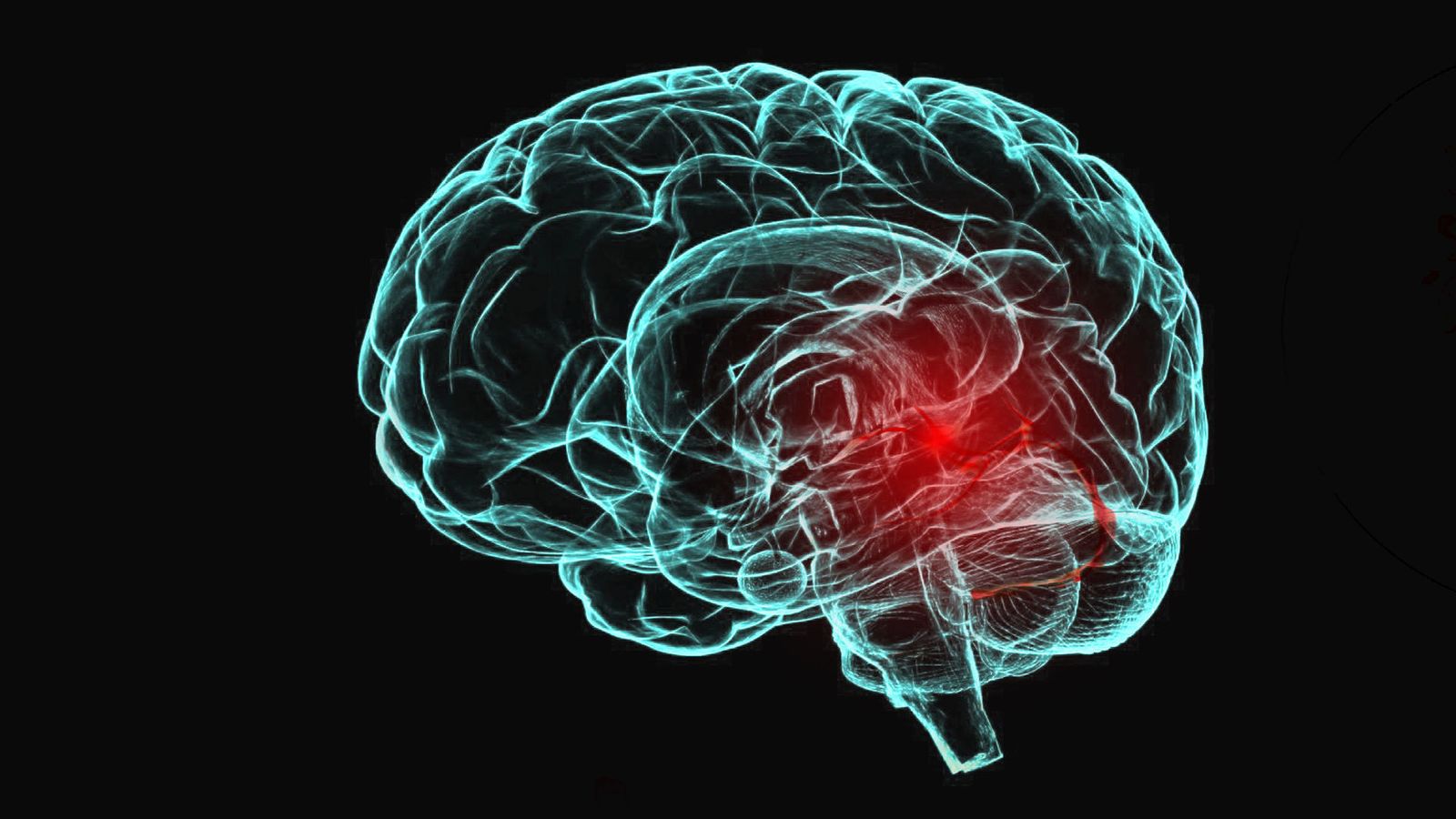 Daño cerebral