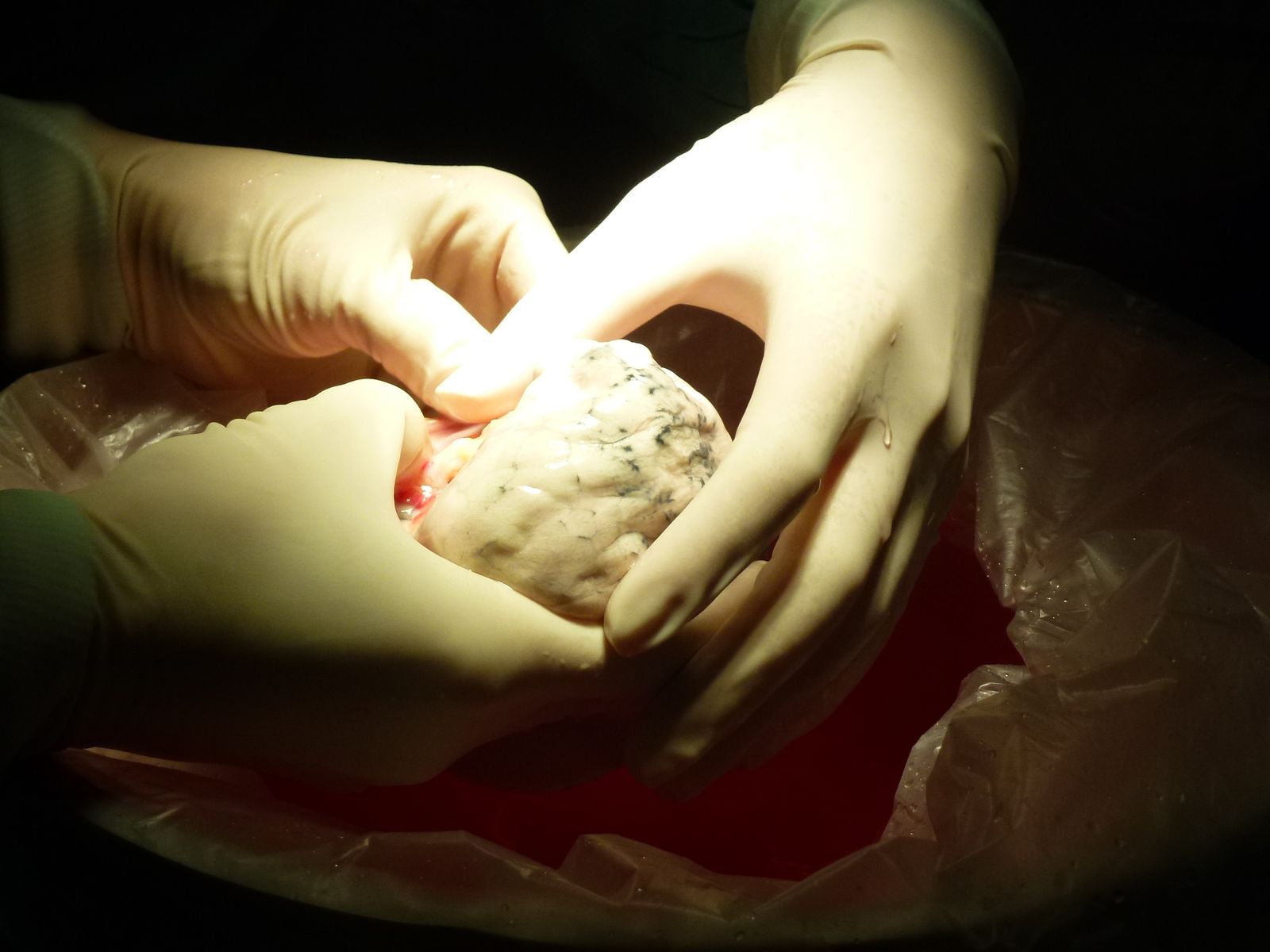 La Paz, los grandes hitos de un hospital pionero