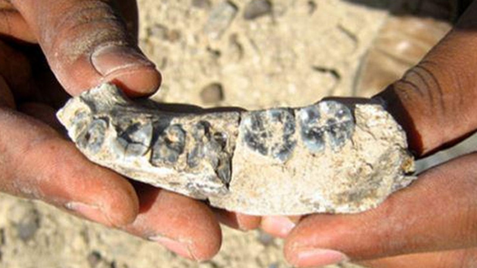 mandibula32456