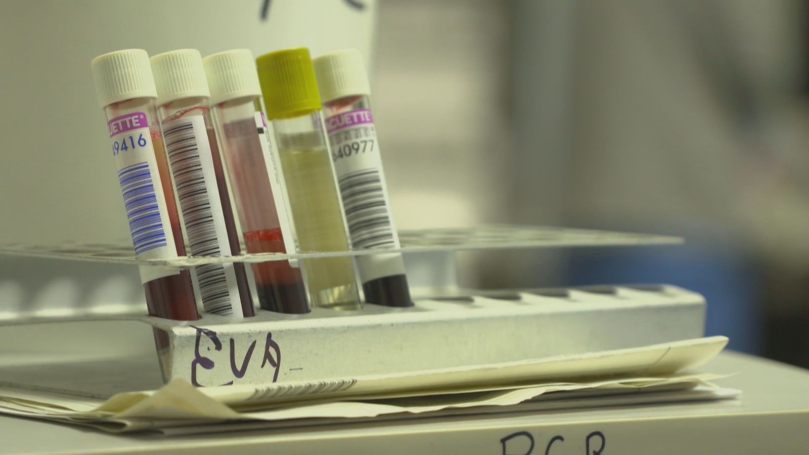 España registra 12 casos del virus Oropouche, Italia 5 y Alemania 2, según el nuevo informe del ECDC