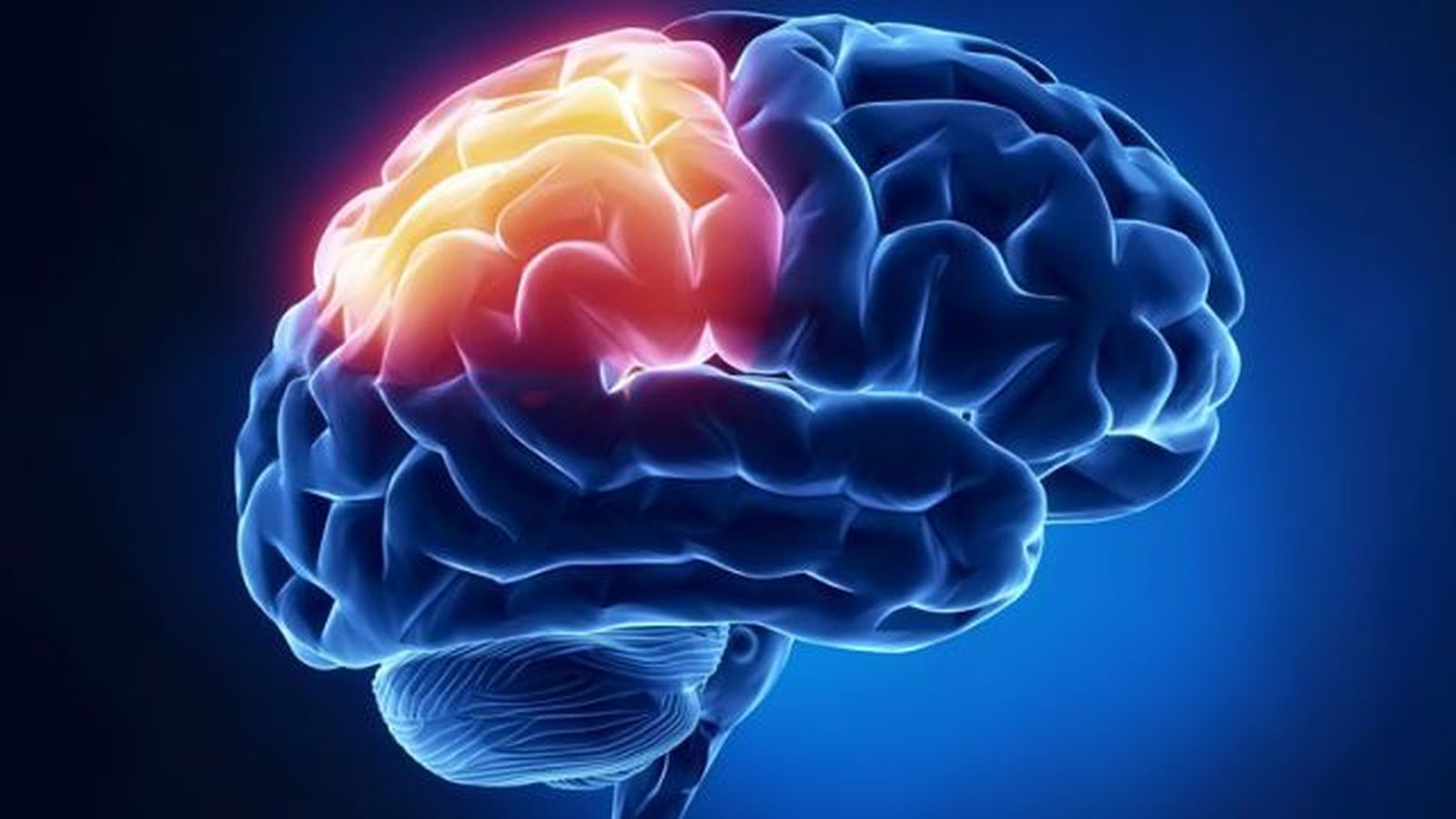 Desmontamos los falsos mitos sobre el ictus