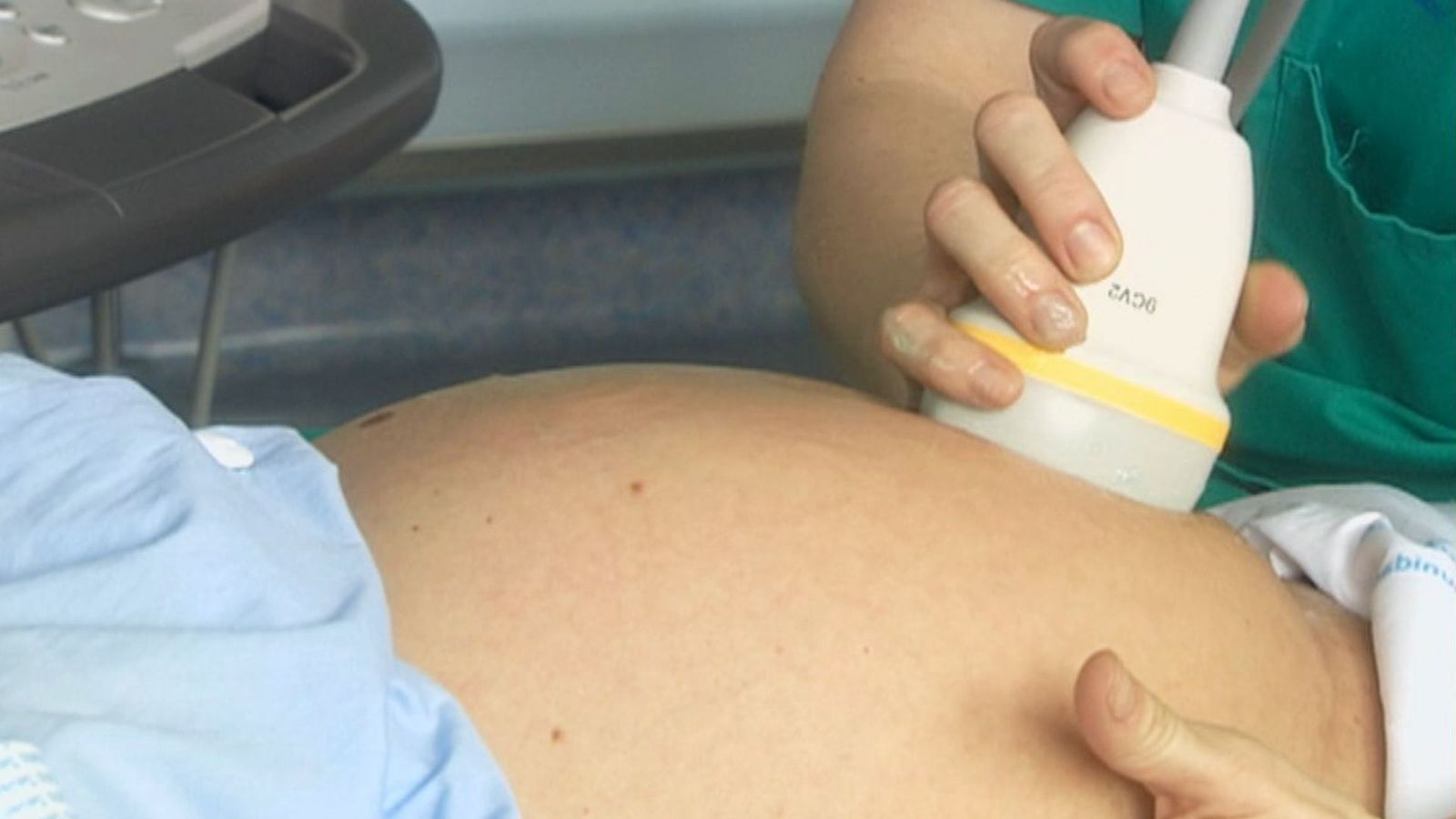 La Federación Española del Duelo Perinatal: “No nos gusta la terminología de ‘bebé no nacido’”