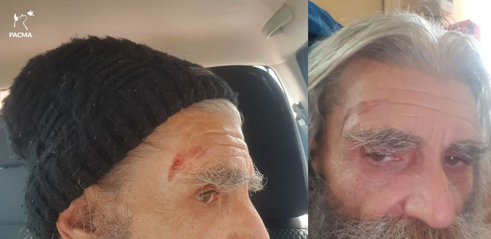 El actor Adolfo Gómez, conocido como Peter Macgiver, denuncia haber sido atacado por unos cazadores en Talamanca de Jarama