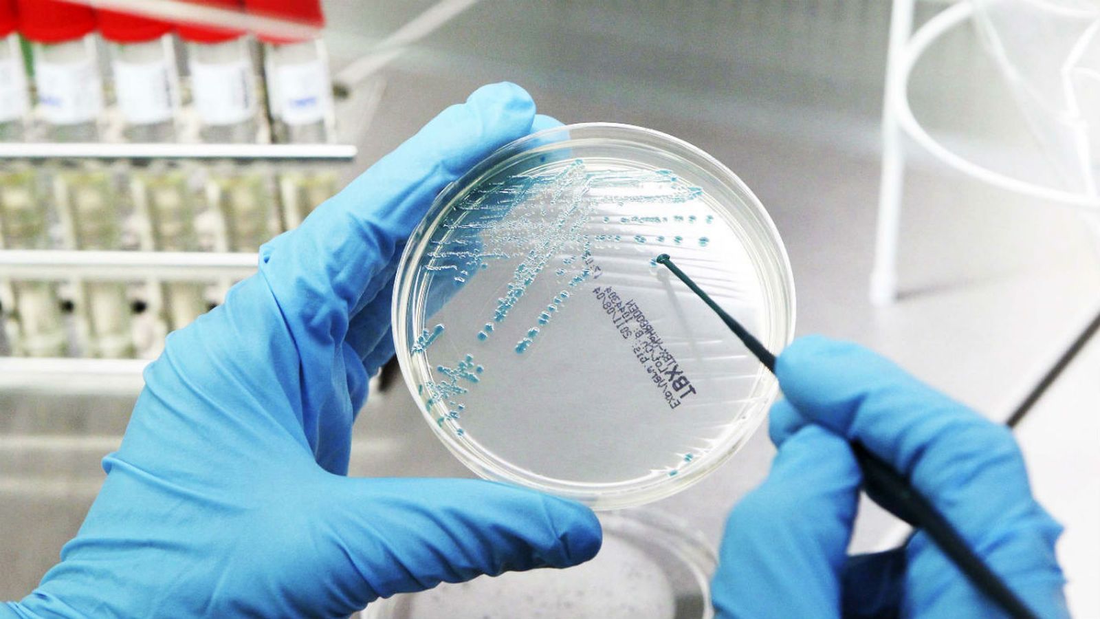 Investigación en la lucha contra el Cáncer