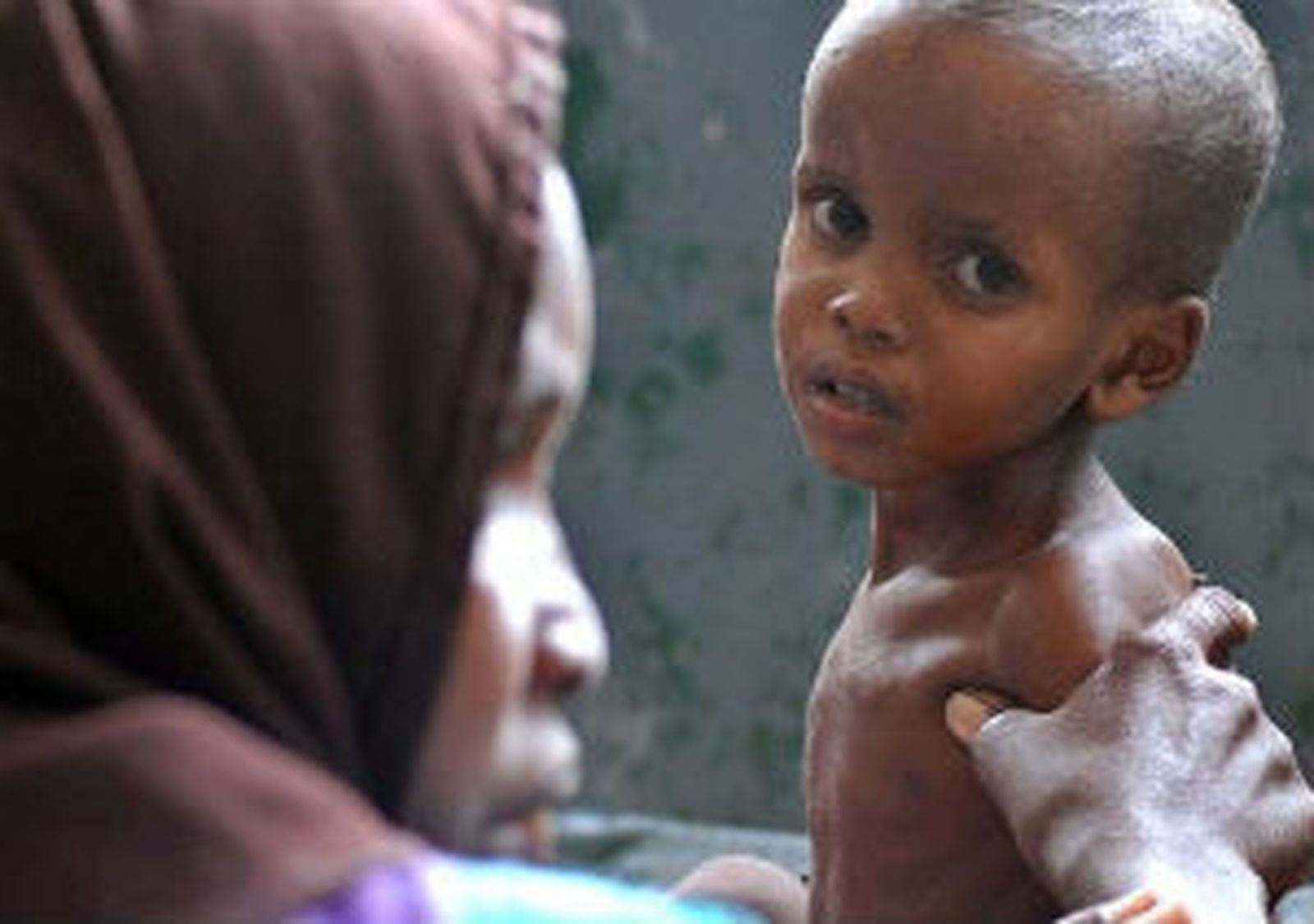 La ONU declara la situación de hambruna en dos regiones del sur de Somalia