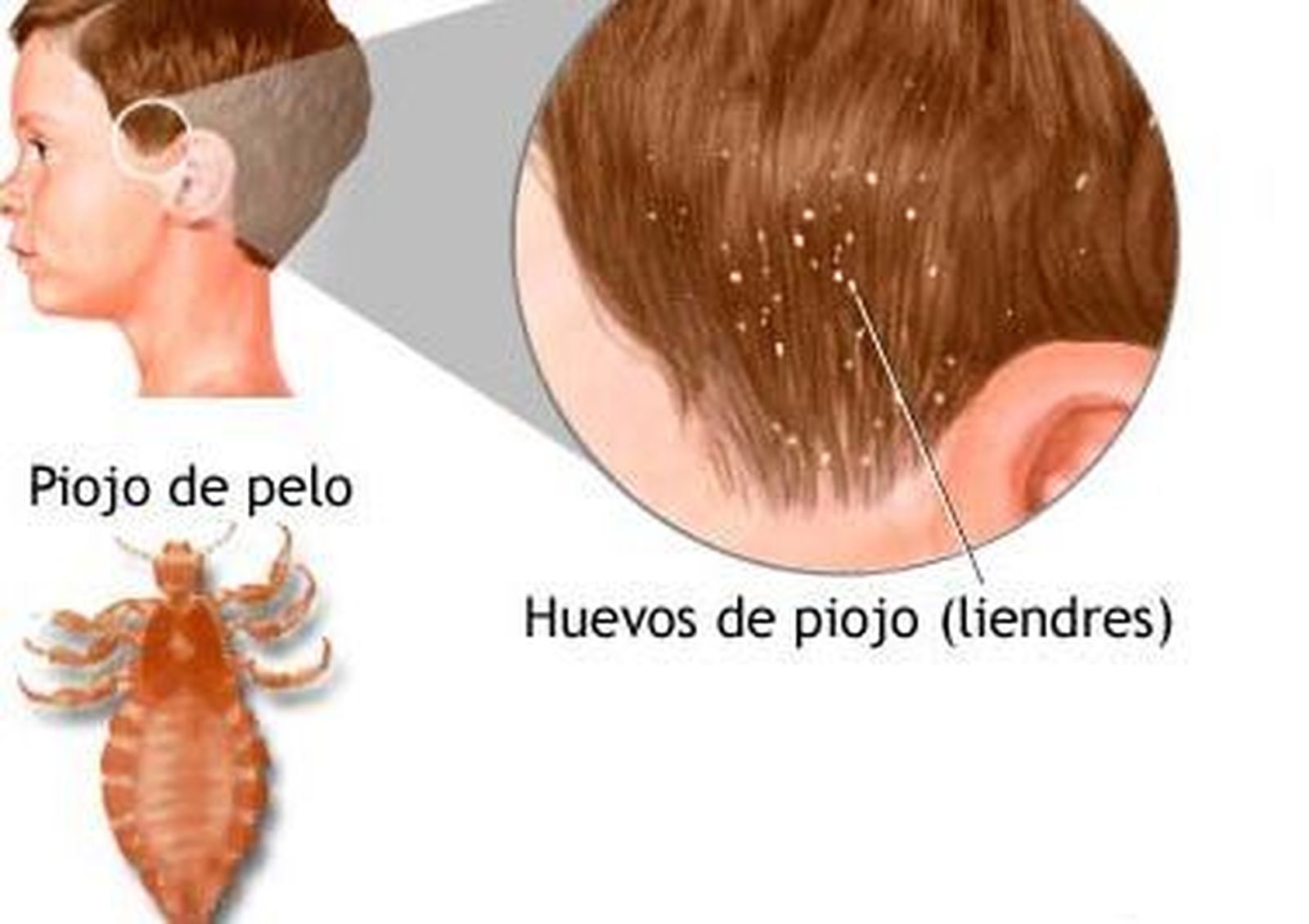 Dolores de espalda y pies, mala visión y la aparición  de piojos, problemas típicos de la vuelta al cole