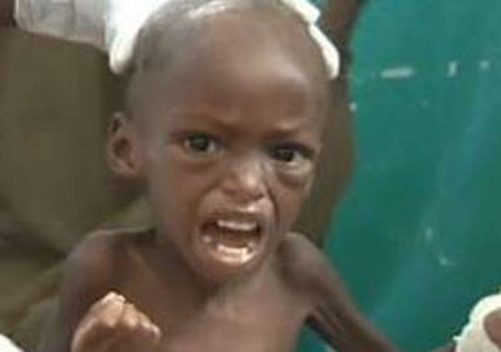 Unos 18.000 niños mueren al día en el mundo por causas evitables