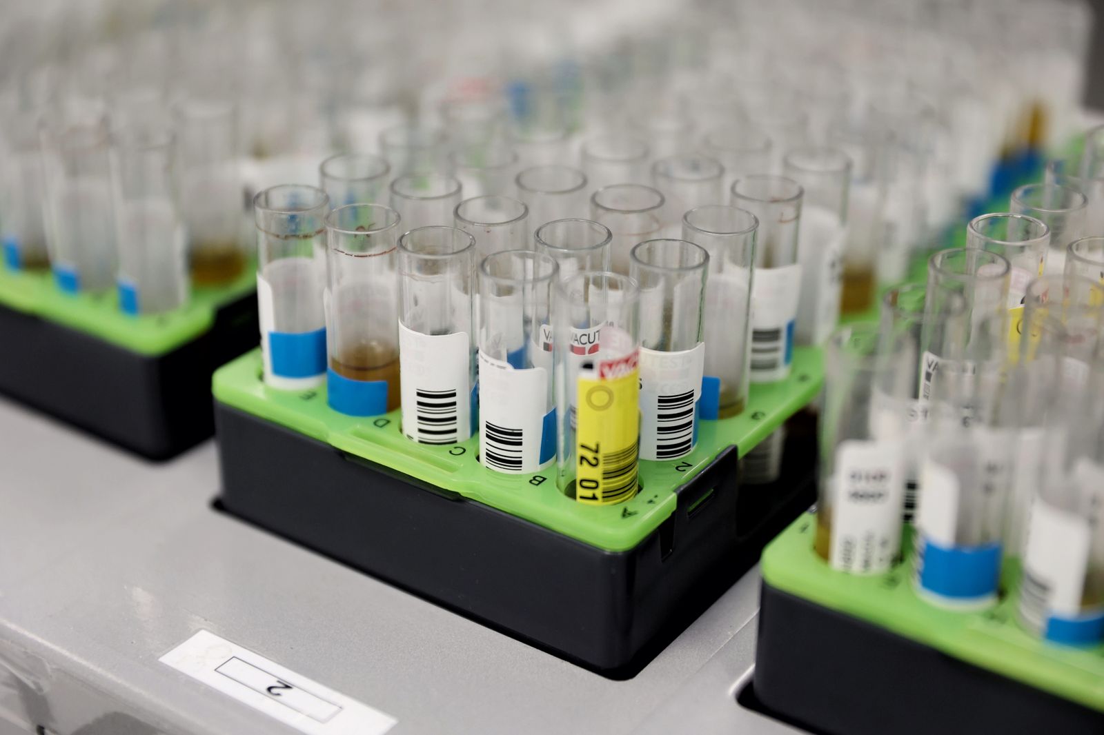 Probetas de pruebas PCR en el Laboratorio de Microbiología del Hospital Gregorio Marañón